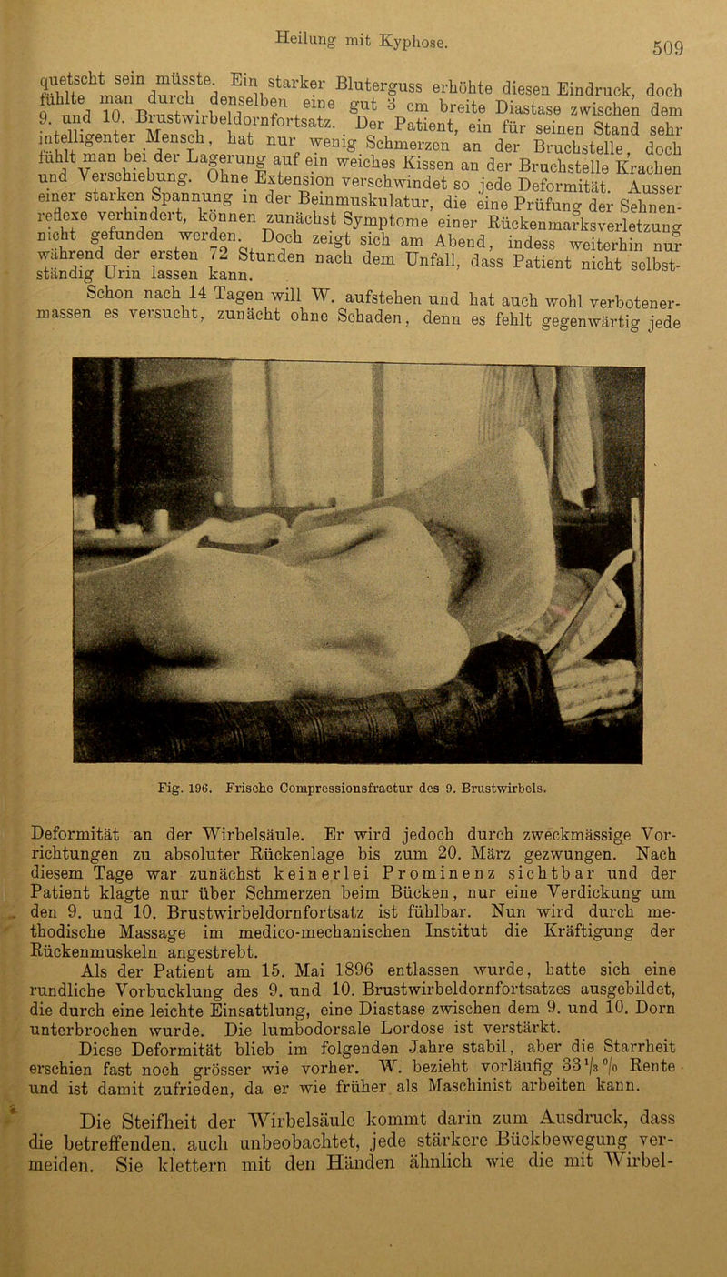 509 quetylit sein musste Ein starker Bluterguss erhöhte diesen Eindruck, doch d und To BrüsttirheTö ef‘\e!r 3 cm breite M»*»» fischet dem J und 0. Biustnnbe doinfortsatz. Der Patient, ein für seinen Stand sehr intelligenter Mensch, hat nur wenig Schmerzen an der Bruchstelle, doch fühlt man bei dei Lagerung auf ein weiches Kissen an der Bruchstelle Krachen und Verschiebung. Ohne Extension verschwindet so jede Deformität. Ausser einer starken Spannung in der Beinmuskulatur, die eine Prüfung der Sehnen- reflexe verhindert, können zunächst Symptome einer Rückenmariisverletzung nicht gefunden werden Doch zeigt sich am Abend, indess weiterhin nu°r wahrend der ersten 72 Stunden nach dem Unfall, dass Patient nicht selbst- ständig Urin lassen kann. Schon nach 14 Tagen will W. aufstehen und hat auch wohl verbotener- massen es versucht, zunächt ohne Schaden, denn es fehlt gegenwärtig jede Fig. 196. Frische Compressionsfractur des 9. Brustwirbels. Deformität an der Wirbelsäule. Er wird jedoch durch zweckmässige Vor- richtungen zu absoluter Rückenlage bis zum 20. März gezwungen. Nach diesem Tage war zunächst keinerlei Prominenz sichtbar und der Patient klagte nur über Schmerzen beim Bücken, nur eine Verdickung um den 9. und 10. Brustwirbeldornfortsatz ist fühlbar. Nun wird durch me- thodische Massage im medico-mechanischen Institut die Kräftigung der Rückenmuskeln angestrebt. Als der Patient am 15. Mai 1896 entlassen wurde, hatte sich eine rundliche Vorbucklung des 9. und 10. Brustwirbeldornfortsatzes ausgebildet, die durch eine leichte Einsattlung, eine Diastase zwischen dem 9. und 10. Dorn unterbrochen wurde. Die lumbodorsale Lordose ist verstärkt. Diese Deformität blieb im folgenden Jahre stabil, aber die Starrheit erschien fast noch grösser wie vorher. W. bezieht vorläufig 331/a °/o Rente und ist damit zufrieden, da er wie früher als Maschinist arbeiten kann. Die Steifheit der Wirbelsäule kommt darin zum Ausdruck, dass die betreffenden, auch unbeobachtet, jede stärkere Bückbewegung ver- meiden. Sie klettern mit den Händen ähnlich wie die mit Wirbel-