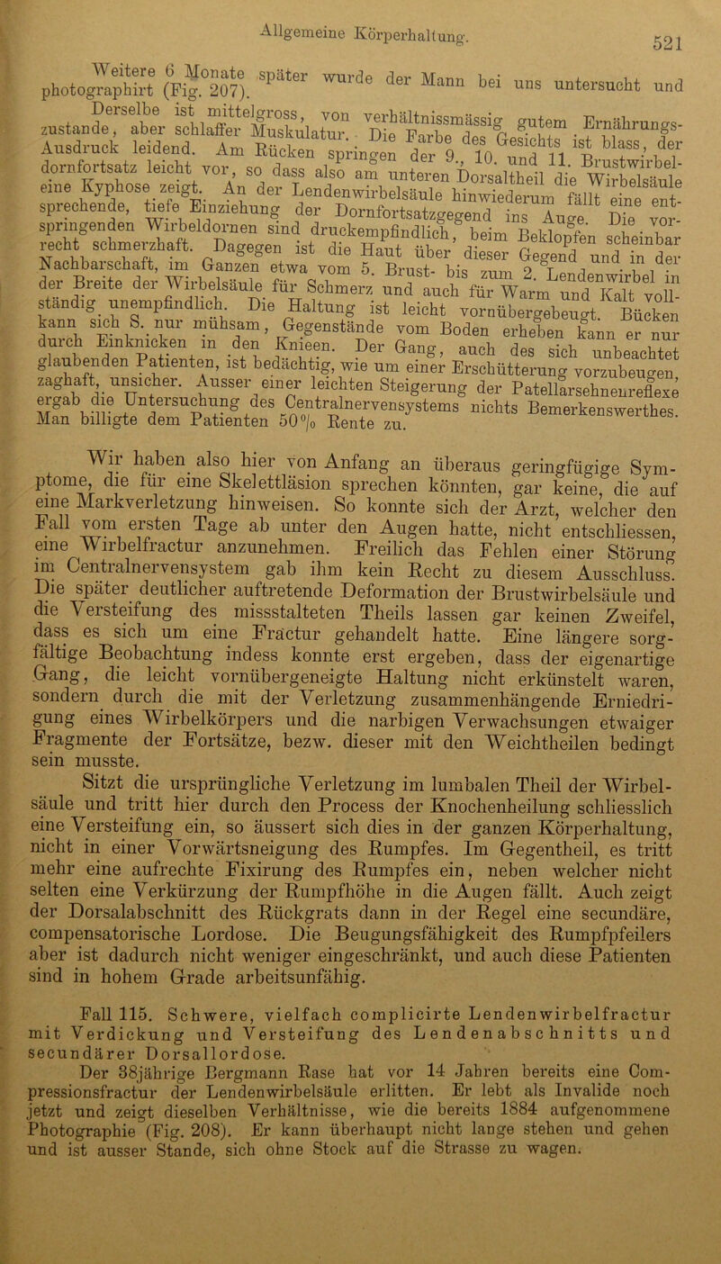 photographirt (Fif °207). 'SPat6r WU1’de der Mann bei mis untersucht und zustande6!^aber schlX^ifuXüater1 Di^FarXd^81 P • Ernährungs‘ Ausdruck leidend a™ p««i ■ D Earbe des Gesichts ist blass, der AusaiUCK leiaena. Am Kucken springen der 9., 10. und 11 Brustwirbel dornfortsatz leicht vor so dass also am unteren Dorsaltheil die Äl eine Kyphose zeigt. An der Lendenwirbelsäule hinwiederum fällt eine ent sprechende, tiefe Einziehung der Dornfortsatzgegend ins Aule Die vor- rilfw druckempfindlich, beim Beklopfen scheinbar lecht schmeizhart. dagegen ist die Haut über dieser Gegend und in der Nachbarschaft, un Ganzen etwa Tom 5. Brust- bis zum 2. Lendenwirbel in der Breite der Wirbelsäule für Schmerz und auch für Warm und Kalt to N ständig, unempfindlich Die Haltung ist leicht vornübergebeugt Bücken durch SEhilmicken ^n^den’ fUdeem^Der Gang^°auch W glaubenden Patienten, ist bedächtig, wie um eine! Erschütterung^ Torzubeugen zaghaft unsicher. Ausser einer leichten Steigerung der PatellarsehneniXe eigab dm Unteisuchung des Centralnervensystems nichts Bemerkenswertes. Man billigte dem Patienten 50 °/0 Rente zu. baben. a^s° bjer yon Anfang an überaus geringfügige Sym- ptome, die für eine Skelettläsion sprechen könnten, gar keine die auf eine Markverletzung kinweisen. So konnte sich der Arzt, welcher den Fail vom ersten Tage ab unter den Augen hatte, nicht entschliessen, eine YVirbelfractur anzunehmen. Freilich das Fehlen einer Störung im Centralnervensystem gab ihm kein Hecht zu diesem Ausschluss. Die später deutlicher auftretende Deformation der Brustwirbelsäule und die \ei steifung des missstalteten Theils lassen gar keinen Zweifel, dass es sich um eine Fräctur gehandelt hatte. Eine längere sorg- fältige Beobachtung indess konnte erst ergeben, dass der eigenartige Dang, die leicht vornübergeneigte Haltung nicht erkünstelt waren, sondern durch die mit der Verletzung zusammenhängende Erniedri- gung eines Wirbelkörpers und die narbigen Verwachsungen etwaiger Fragmente der Fortsätze, bezw. dieser mit den Weichtheilen bedingt sein musste. Sitzt die ursprüngliche Verletzung im lumbalen Theil der Wirbel- säule und tritt hier durch den Process der Knochenheilung schliesslich eine Versteifung ein, so äussert sich dies in der ganzen Körperhaltung, nicht in einer Vorwärtsneigung des Eumpfes. Im Gegentheil, es tritt mehr eine aufrechte Fixirung des Eumpfes ein, neben welcher nicht selten eine Verkürzung der Eumpfhöhe in die Augen fällt. Auch zeigt der Dorsalabschnitt des Hiickgrats dann in der Eegel eine secundäre, compensatorische Lordose. Die Beugungsfähigkeit des Eumpfpfeilers aber ist dadurch nicht weniger eingeschränkt, und auch diese Patienten sind in hohem Grade arbeitsunfähig. Fall 115. Schwere, vielfach complicirte Lenden wir belfractur mit Verdickung und Versteifung des Lendenabschnitts und secundärer Dorsallordose. Der 38jährige Bergmann Rase hat vor 14 Jahren bereits eine Com- pressionsfractur der Lendenwirbelsäule erlitten. Er lebt als Invalide noch jetzt und zeigt dieselben Verhältnisse, wie die bereits 1884 aufgenommene Photographie (Fig. 208). Er kann überhaupt nicht lange stehen und gehen und ist ausser Stande, sich ohne Stock auf die Strasse zu wagen.