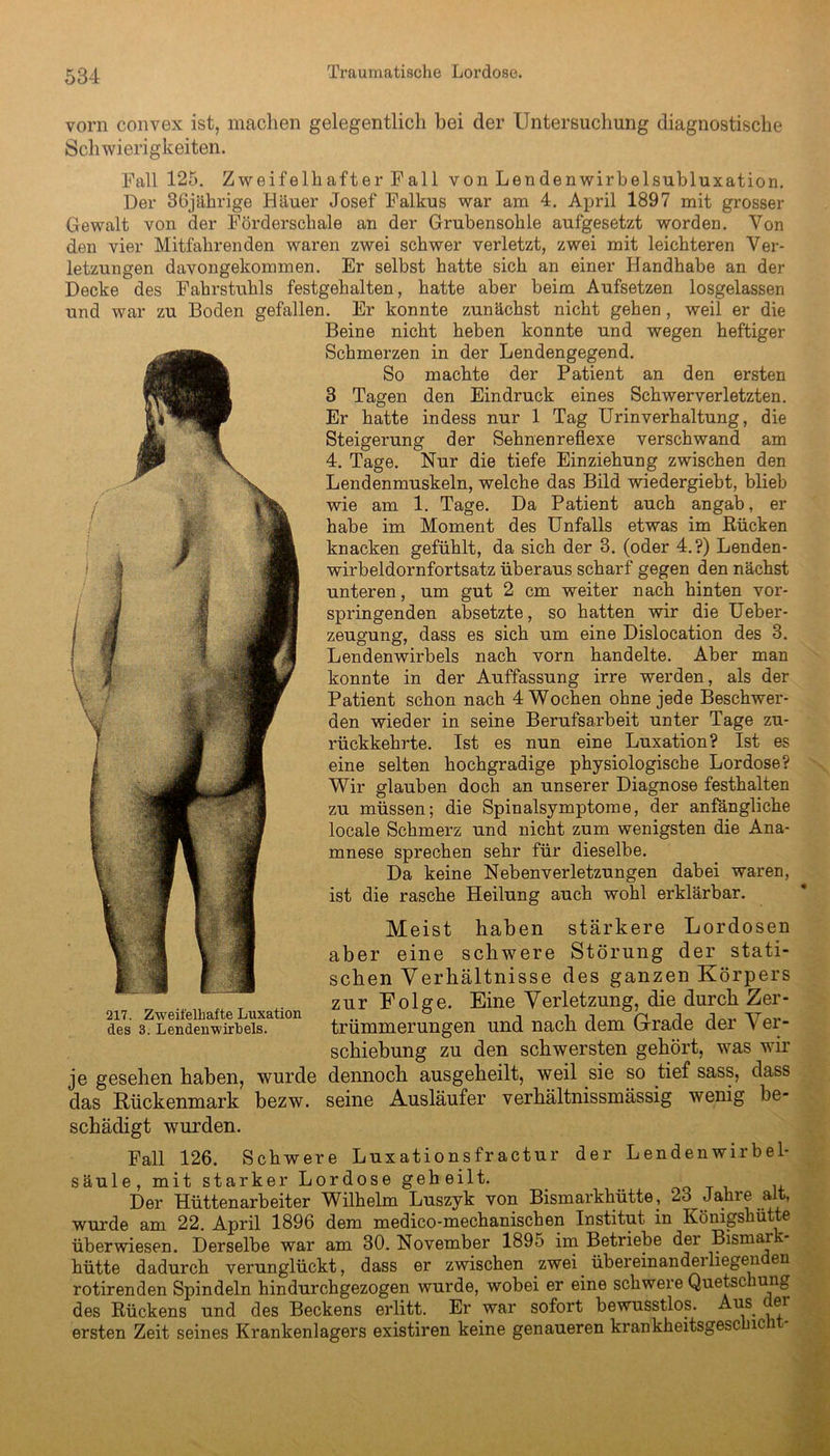 vorn convex ist, machen gelegentlich bei der Untersuchung diagnostische Schwierigkeiten. Fall 125. Zweifelhafter Fall von Lendenwirbelsubluxation. Der 36jährige Häuer Josef Falkus war am 4. April 1897 mit grosser Gewalt von der Förderschale an der Grubensohle aufgesetzt worden. Von den vier Mitfahrenden waren zwei schwer verletzt, zwei mit leichteren Ver- letzungen davongekommen. Er selbst hatte sich an einer Handhabe an der Decke des Fahrstuhls festgehalten, hatte aber beim Aufsetzen losgelassen und war zu Boden gefallen. Er konnte zunächst nicht gehen, weil er die Beine nicht heben konnte und wegen heftiger Schmerzen in der Lendengegend. So machte der Patient an den ersten 3 Tagen den Eindruck eines Schwerverletzten. Er hatte indess nur 1 Tag Urinverhaltung, die Steigerung der Sehnenreflexe verschwand am 4. Tage. Nur die tiefe Einziehung zwischen den Lendenmuskeln, welche das Bild wiedergiebt, blieb wie am 1. Tage. Da Patient auch angab, er habe im Moment des Unfalls etwas im Rücken knacken gefühlt, da sich der 3. (oder 4.?) Lenden- wirbeldornfortsatz überaus scharf gegen den nächst unteren, um gut 2 cm weiter nach hinten vor- springenden absetzte, so hatten wir die Ueber- zeugung, dass es sich um eine Dislocation des 3. Lendenwirbels nach vorn handelte. Aber man konnte in der Auffassung irre werden, als der Patient schon nach 4 Wochen ohne jede Beschwer- den wieder in seine Berufsarbeit unter Tage zu- rückkehrte. Ist es nun eine Luxation? Ist es eine selten hochgradige physiologische Lordose? Wir glauben doch an unserer Diagnose festhalten zu müssen; die Spinalsymptome, der anfängliche locale Schmerz und nicht zum wenigsten die Ana- mnese sprechen sehr für dieselbe. Da keine Nebenverletzungen dabei waren, ist die rasche Heilung auch wohl erklärbar. Meist haben stärkere Lordosen aber eine schwere Störung der stati- schen Verhältnisse des ganzen Körpers zur Folge. Eine Verletzung, die durch Zer- trümmerungen und nach dem Grade der V er- schiebung zu den schwersten gehört, was wir je gesehen haben, wurde dennoch ausgeheilt, weil sie so tief sass, dass das Rückenmark bezw. seine Ausläufer verhältnissmässig wenig be- schädigt wurden. Fall 126. Schwere Luxationsfractur der Lendenwirbel- säule, mit starker Lordose geheilt. Der Hüttenarbeiter Wilhelm Luszyk von Bismarkhütte, 23 Jahre alt, wurde am 22. April 1896 dem medico-mechanischen Institut in Kömgshutte überwiesen. Derselbe war am 30. November 1895 im Betriebe der Bismai. hütte dadurch verunglückt, dass er zwischen zwei. übereinanderliegen en rotirenden Spindeln hindurchgezogen wurde, wobei er eine schwere Quetsc 1U11£> des Rückens und des Beckens erlitt. Er war sofort bewusstlos. Aus. c ei ersten Zeit seines Krankenlagers existiren keine genaueren krankheitsgesc ic i 217. Zweifelhafte Luxation des 3. Lendenwirbels.