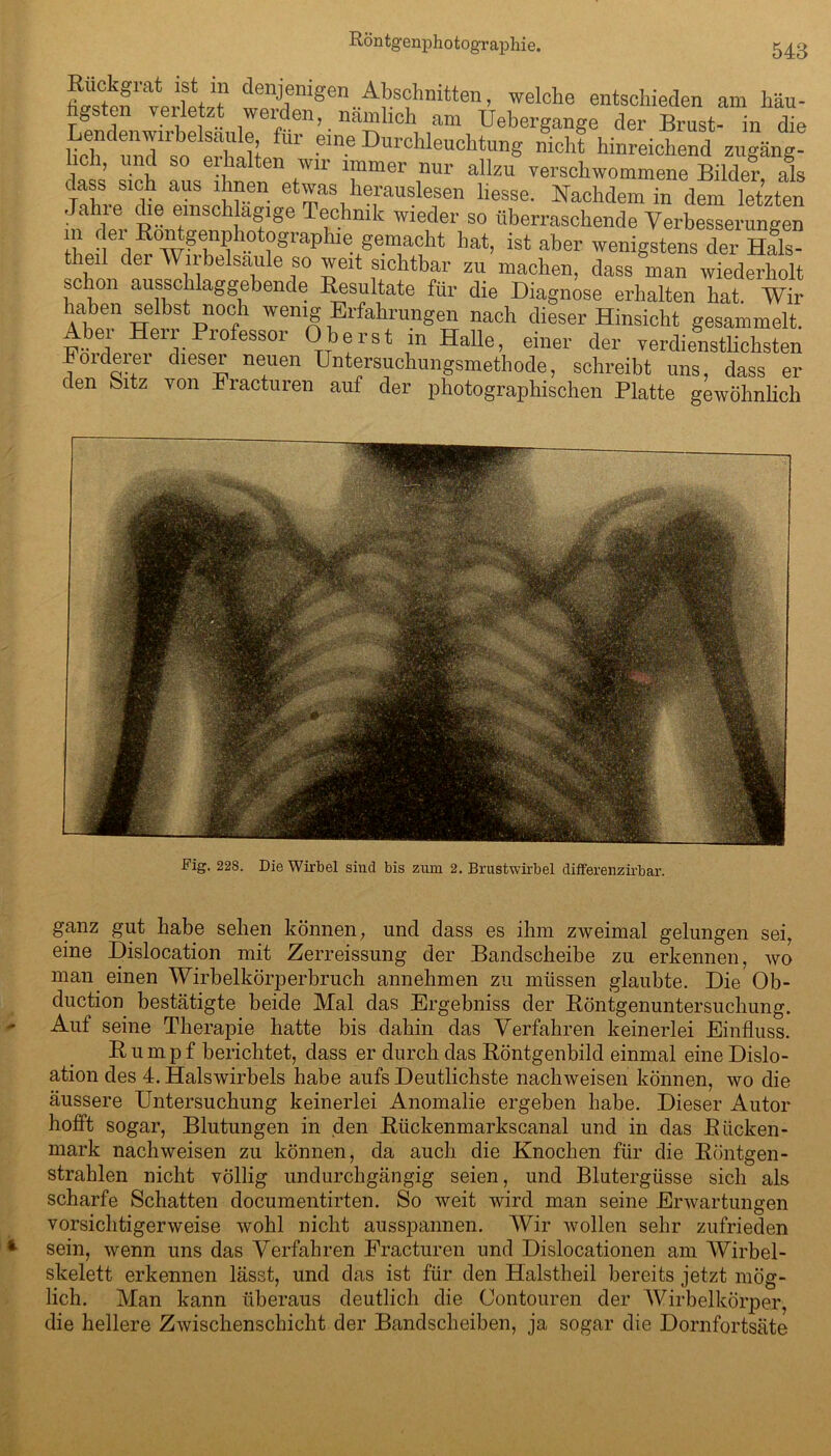 Rückgrat ist in denjenigen Abschnitten, welche entschieden am häu- Ds en Ter e z weiden, nämlich am Uebergange der Brust- in die hclf Zto erb 1t ' ?ln.e Durchleuchtung nicht hinreichend Zugang! c , nd so erhalten wir immer nur allzu verschwommene Bilder, als dass sich aus ihnen etwas herauslesen liesse. Nachdem in dem letzten Jahie die einschlägige Technik wieder so überraschende Verbesserungen in der Rontgenphotographie gemacht hat, ist aber wenigstens der Hfl” theil der Wirbelsäule so weit sichtbar zu machen, dass man wiederholt schon ausschlaggebende Resultate für die Diagnose erhalten hat. Wir haben selbst noch wenig Erfahrungen nach dieser Hinsicht gesammelt. Abei Heil Piofessor Oberst m Halle, einer der verdienstlichsten Förderer dieser neuen Untersuchungsmethode, schreibt uns, dass er den Sitz von Eracturen auf der photographischen Platte gewöhnlich Fig. 22S. Die Wirbel sind bis zum 2. Brustwirbel differenzirbar. ganz gut habe sehen können, und dass es ihm zweimal gelungen sei, eine Dislocation mit Zerreissung der Bandscheibe zu erkennen, wo man einen Wirbelkörperbruch annehmen zu müssen glaubte. Die Ob- duction bestätigte beide Mal das Ergebniss der Röntgenuntersuchung. Auf seine Therapie hatte bis dahin das Verfahren keinerlei Einfluss. Rumpf berichtet, dass er durch das Röntgenbild einmal eineDislo- ation des 4. Halswirbels habe aufs Deutlichste nacliweisen können, wo die äussere Untersuchung keinerlei Anomalie ergeben habe. Dieser Autor hofft sogar, Blutungen in den Rückenmarkscanal und in das Rücken- mark nacliweisen zu können, da auch die Knochen für die Röntgen- strahlen nicht völlig undurchgängig seien, und Blutergüsse sich als scharfe Schatten documentirten. So weit wird man seine Erwartungen vorsichtigerweise wohl nicht ausspannen. Wir wollen sehr zufrieden sein, wenn uns das Verfahren Eracturen und Dislocationen am Wirbel- skelett erkennen lässt, und das ist für den Halstheil bereits jetzt mög- lich. Man kann überaus deutlich die Contouren der Wirbelkörper, die hellere Zwischenschicht der Bandscheiben, ja sogar die Dornfortsäte