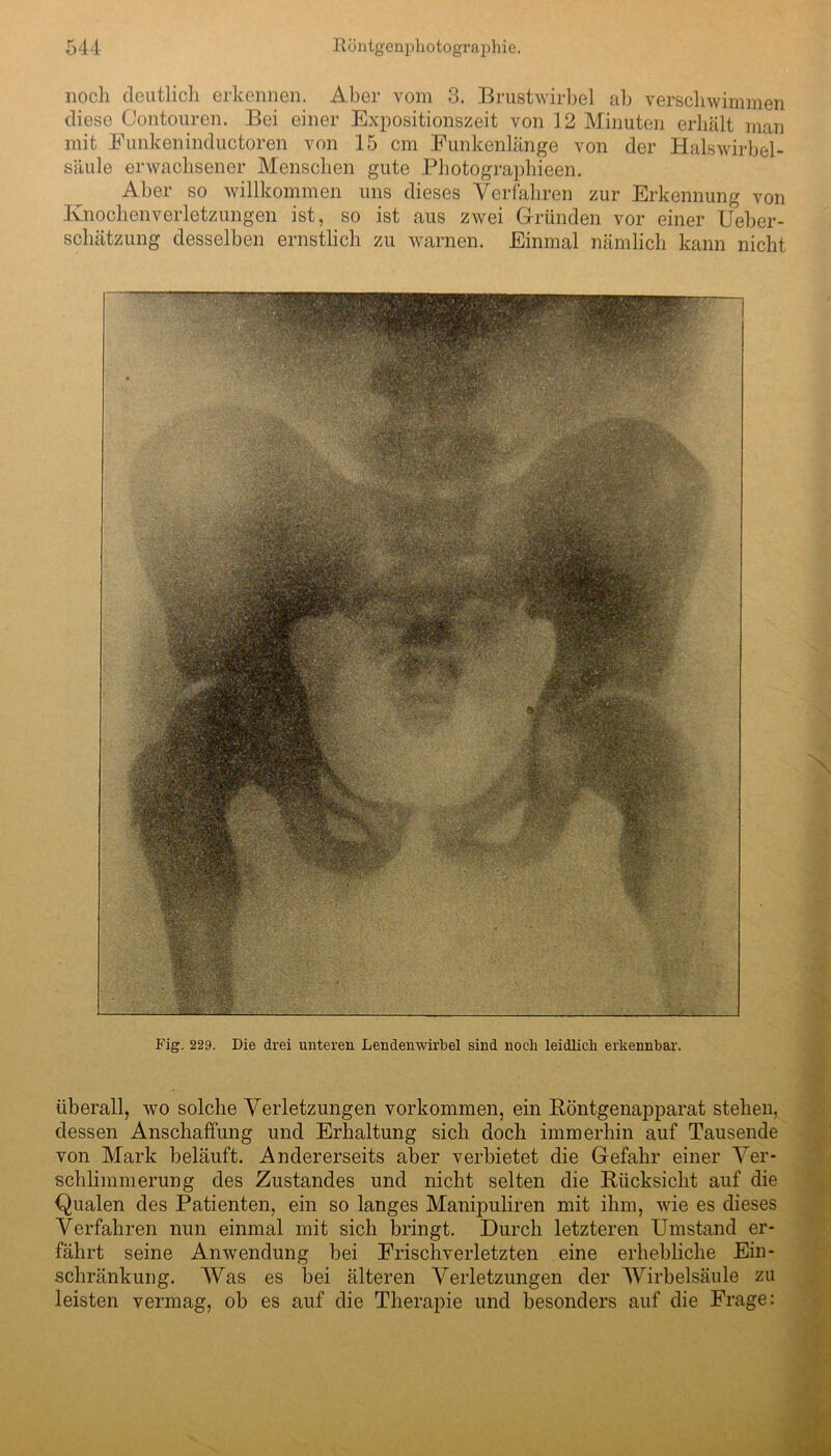 noch deutlich erkennen. Aber vom 3. Brustwirbel ab verschwimmen diese Contouren. Bei einer Expositionszeit von 12 Minuten erhält man mit Eunkeninductoren von 15 cm Funkenlänge von der Halswirbel- säule erwachsener Menschen gute Photographieen. Aber so willkommen uns dieses Verfahren zur Erkennung von .Knochen vei letzungen ist, so ist aus zwei Gründen vor einer Ueber- Schätzung desselben ernstlich zu warnen. Einmal nämlich kann nicht Fig. 229. Die drei unteren Lendenwirbel sind noch leidlich erkennbar. überall, wo solche Verletzungen Vorkommen, ein Röntgenapparat stehen, dessen Anschaffung und Erhaltung sich doch immerhin auf Tausende von Mark beläuft. Andererseits aber verbietet die Gefahr einer Ver- schlimmerung des Zustandes und nicht selten die Rücksicht auf die Qualen des Patienten, ein so langes Manipuliren mit ihm, wie es dieses Verfahren nun einmal mit sich bringt. Durch letzteren Umstand er- fährt seine Anwendung bei Frischverletzten eine erhebliche Ein- schränkung. Was es bei älteren Verletzungen der Wirbelsäule zu leisten vermag, ob es auf die Therapie und besonders auf die Frage: