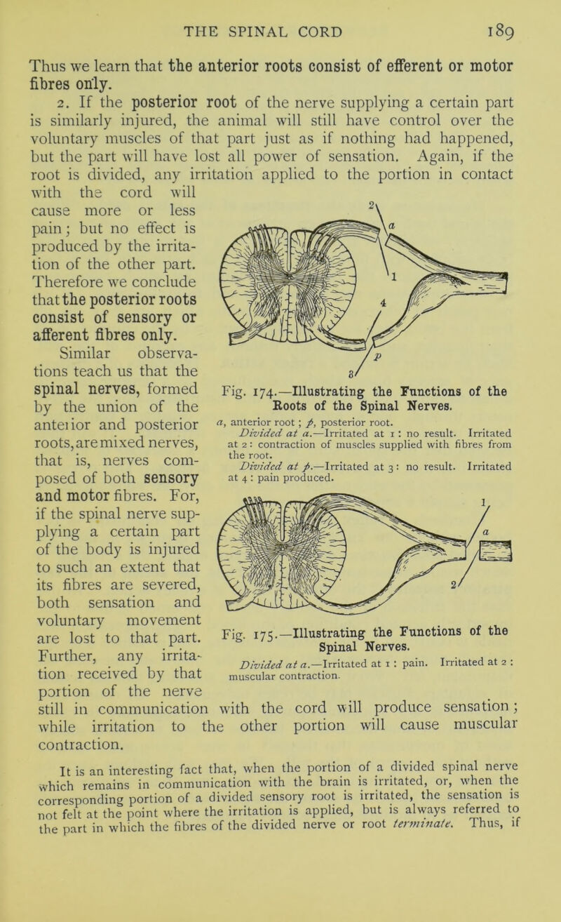 Thus we learn that the anterior roots consist of efferent or motor fibres only. 2. If the posterior root of the nerve supplying a certain part is similarly injured, the animal will still have control over the voluntary muscles of that part just as if nothing had happened, but the part will have lost all power of sensation. Again, if the root is divided, any irritation applied to the portion in contact with the cord will cause more or less pain; but no effect is produced by the irrita- tion of the other part. Therefore we conclude that the posterior roots consist of sensory or afferent fibres only. Similar observa- tions teach us that the spinal nerves, formed by the union of the anteiior and posterior roots, are mixed nerves, that is, nerves com- posed of both sensory and motor fibres. For, if the spinal nerve sup- plying a certain part of the body is injured to such an extent that its fibres are severed, both sensation and voluntary movement are lost to that part. Further, any irrita- tion received by that portion of the nerve still in communication with the cord will produce sensation; while irritation to the other portion will cause muscular contraction. It is an interesting fact that, when the portion of a divided spinal nerve which remains in communication with the brain is irritated, or, when the corresponding portion of a divided sensory root is irritated, the sensation is not felt at the point where the irritation is applied, but is always referred to the part in which the fibres of the divided nerve or root tenmnate. Thus, if Fig. 174.—Illustrating the Functions of the Roots of the Spinal Nerves. a, anterior root; A posterior root. Divided at a.—Irritated at i ; no result. Irritated at 2: contraction of muscles supplied with fibres from the root. Divided at j>.—Irritated at 3 : no result. Irritated at 4 : pain produced. Fig. 175.—Illustrating the Functions of the Spinal Nerves. Divided at <1.—Irritated at i : pain. Irritated at 2 : muscular contraction.