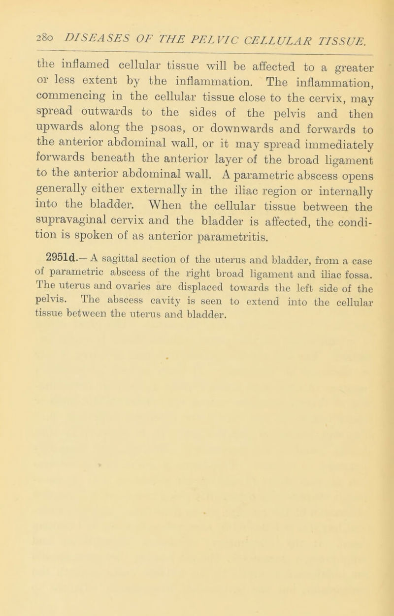 “So DISEASES OE THE PELVIC CELLULAR TISSUE. the inflamed cellular tissue will be affected to a greater or less extent by the inflammation. The inflammation, commencing in the cellular tissue close to the cervix, may spread outwards to the sides of the pelvis and then upwards along the psoas, or downwards and forwards to the anterior abdominal wall, or it may spread immediately forwards beneath the anterior layer of the broad ligament to the anterior abdominal wall. A parametric abscess opens generally either externally in the iliac region or internally into the bladder. When the cellular tissue between the supravaginal cervix and the bladder is affected, the condi- tion is spoken of as anterior parametritis. 2951d. A sagittal section of the uterus and bladder, from a case ot parametric abscess of the right broad ligament and iliac fossa. I he uterus and ovaries are displaced towards the left side of the pelvis. The abscess cavity is seen to extend into the cellular tissue between the uterus and bladder.