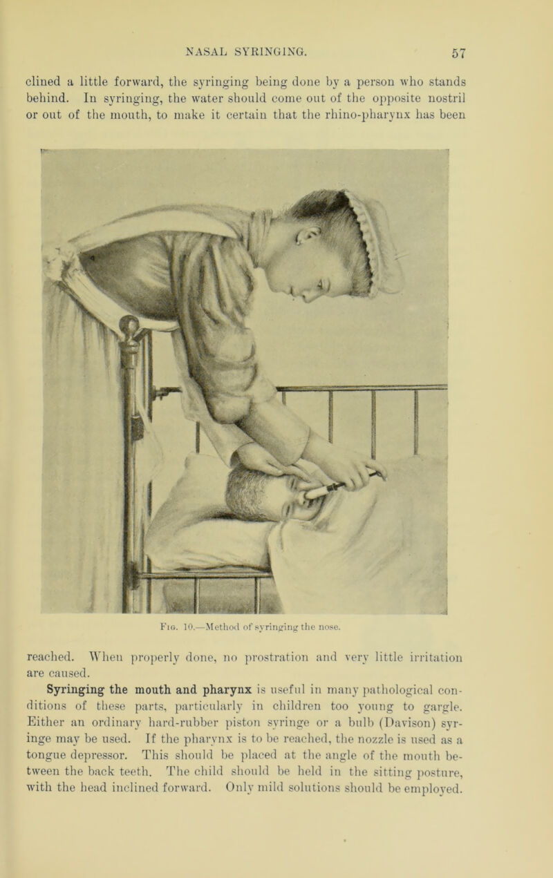 cliued a little forward, the syringing being done by a person who stands behind. In syringing, the water should come out of the opposite nostril or out of the mouth, to make it certain that the rhino-pharynx has been Fig. 10.—Method of syringing’the nose. reached. When properly done, no prostration and very little in-itation are caused. Syringing the mouth and pharynx is useful in many pathological con- ditions of these parts, particularly in children too young to gargle. Either an ordinary hard-rubber jiiston syringe or a bulb (Davison) syr- inge may be used. If the pharynx is to be reached, the nozzle is used as a tongue depressor. This should be placed at the angle of the month be- tween the back teeth. The child should be held in the sitting posture, with the head inclined forward. Only mild solutions should be employed.