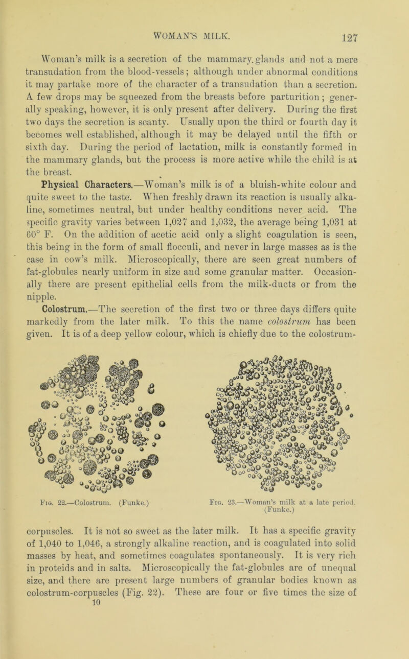 Woman’s milk is a secretion of the mammary.glands and not a mere transudation from the blood-vessels; although under abnormal conditions it may partake more of the character of a transudation than a secretion, A. few drops may be squeezed from the breasts before parturition; gener- ally speaking, however, it is only present after delivery. During the first two days the secretion is scanty. Usually upon the third or fourth day it becomes well established, although it may be delayed until the fifth or sixth day. During the period of lactation, milk is constantly formed in the mammary glands, but the process is more active while the child is at the breast. Physical Characters.—Woman’s milk is of a bluish-white colour and quite sweet to the taste. When freshly drawn its reaction is usually alka- line, sometimes neutral, but under healthy conditions never acid. The specific gravity varies between 1,027 and 1,032, the average being 1,031 at C0° F. On the addition of acetic acid only a slight coagulation is seen, this being in the form of small fiocculi, and never in large masses as is the case in cow’s milk. Microscopically, there are seen great numbers of fat-globules nearly uniform in size and some granular matter. Occasion- ally there are present epithelial cells from the milk-ducts or from the nipple. Colostrum.—The secretion of the first two or three days differs quite markedly from the later milk. To this the name colostrum has been given. It is of a deep yellow colour, which is chiefly due to the colostruni- Fio. 22.—Colostrum. (Funke.) Fio. 23.—Woinnn’.s milk at a late perioU. (Funke.) corpuscles. It is not so sweet as the later milk. It has a specific gravity of 1,040 to 1,046, a strongly alkaline reaction, and is coagulated into solid masses by heat, and sometimes coagulates spontaneously. It is very rich in proteids and in salts. Microscopically the fat-globules are of unequal size, and there are present large numbers of granular bodies known as colostrum-corpuscles (Fig. 22). These are four or five times the size of 10