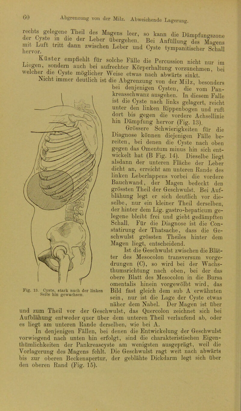 GO Abgrenzung von der Milz. Abweichende Lagerung, echts gelegene Tlieil des Magens leer, so kann die Dämpfungszone der Cyste m die der Leber übergehen. Bei Anfüllung des Magens hervo^-”^ ^-wischen Leber und Cyste tympanitischer Sdiall Küster empfiehlt für solche Fälle die Percussion nicht nur im Liegen, sondern auch bei aufrechter Körperhaltung vorzunehmen, bei welchei die Cyste möglicher Weise etwas nach abwärts sinkt. iNicht immer deutlich ist die Abgrenzung von der Milz, besonders bei denjenigen Cysten, die vom Pan- kreasschwanz ausgehen. In diesem Falle ist die Cyste nach links gelagert, reicht unter den linken Rippenbogen und ruft dort bis gegen die vordere Achsellinie hin Dämpfung hervor (Fig. 13). Grössere Schwierigkeiten für die Diagnose können diejenigen Fälle be- reiten , bei denen die Cyste nach oben gegen das Omentum minus hin sich ent- wickelt hat (B Fig. 14). Dieselbe liegt alsdann der unteren Fläche der Leber dicht an, erreicht am unteren Rande des linken Leberlappens vorbei die vordere Bauchwand, der Magen bedeckt den grössten Theil der Geschwulst. Bei Auf- blähung legt er sich deutlich vor die- selbe, nur ein kleiner Theil derselben, der hinter dem Lig. gastro-hepaticum ge- legene bleibt frei und giebt gedämpften Schall. Für die Diagnose ist die Con- statirung der Thatsache, dass die Ge- schwulst grössten Theiles hinter dem Magen liegt, entscheidend. Ist die Geschwulst zwischen die Blät- ter des Mesocolon transversum vorge- drungen (C), so wird bei der Wachs- thum srichtung nach oben, bei der das obere Blatt des Mesocolon in die Bursa omentalis hinein vorgewölbt wird, das Bild fast gleich dem sub A erwähnten sein, nur ist die Lage der Cyste etwas näher dem Nabel. Der Magen ist über und zum Theil vor der Geschwulst, das Quercolon zeichnet sich bei Aufblähung entweder quer über dem unteren Theil verlaufend ab, oder es liegt am unteren Rande derselben, wie bei A. In denjenigen Fällen, bei denen die Entwickelung der Geschwulst vorwiegend nach unten hin erfolgt, sind die charakteristischen Eigen- thümlichkeiten der Pankreascyste am wenigsten ausgeprägt, weil die Vorlagerung des Magens fehlt. Die Geschwulst ragt weit nach abwärts bis zur oberen Beckenapertur, der geblähte Dickdarm legt sich über den oberen Rand (Fig. 15). Fig. 13. Cyste, stark nach der linken Seite hin gewachsen.