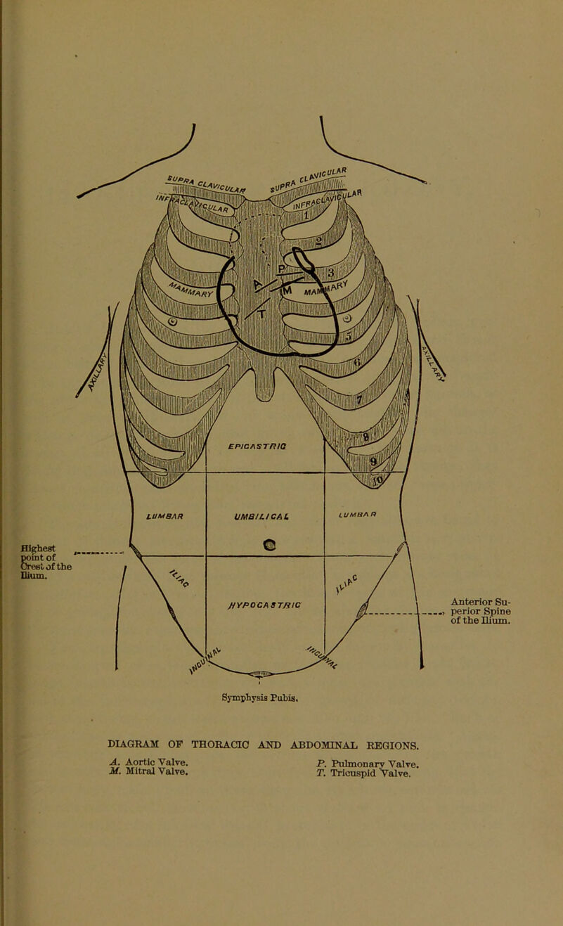 Symphysis Puhis, DIAGRAM OF THORACIC AND ABDOMINAL REGIONS. A. Aortic Valve. M. Mitral Valve. P. Pulmonary Valve. T. Tricuspid Valve. Anterior Su- perior Spine of the Ilium.