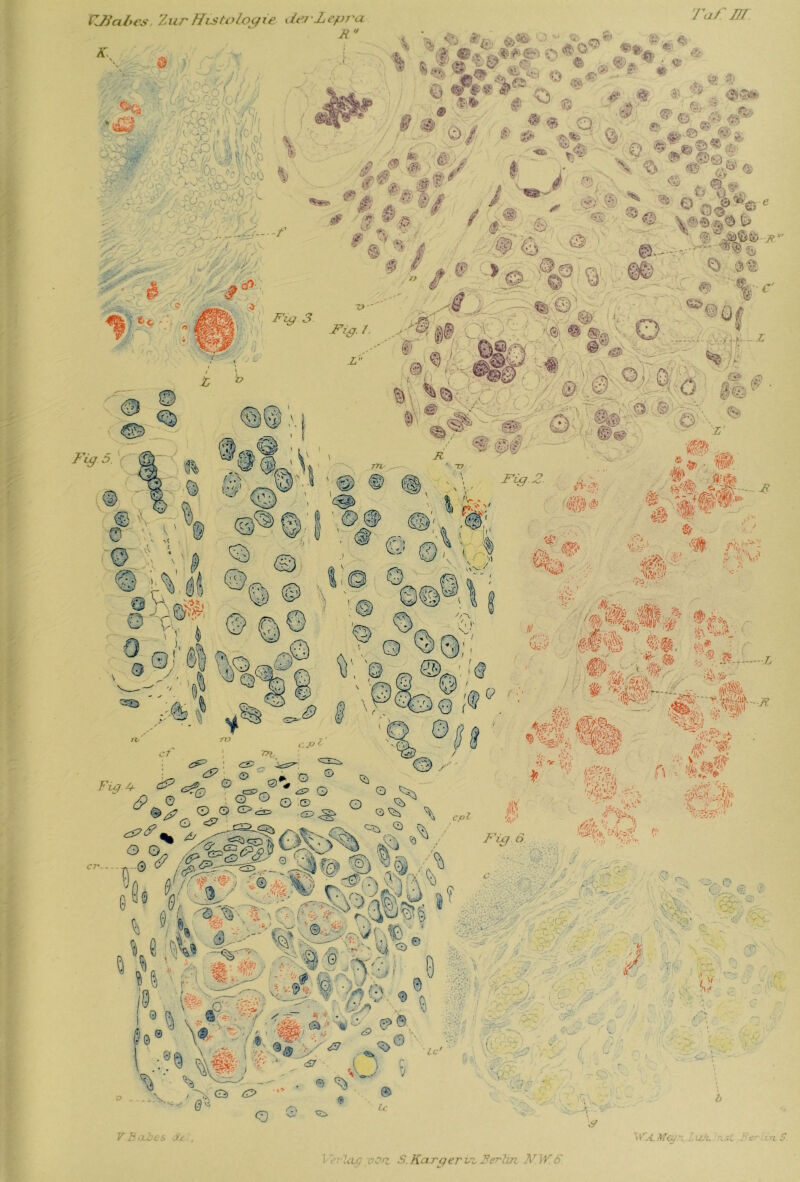 VJiabes. Zur Histologie <ierZepra R ä: ä •, . ,• | \ ■ & ' .-isf A v>VV 8&P Taf m •iö TS- <C’~i & 'p-w *“<•' yti - © ^ 4: ® .-■» . <$®fc v- •~‘.Ä. •' ■ 1 |V #,) .0/ 8 ® ® $' ;•• . Q. ^ % <§)■ ö 0 <© ÄS * ~b <J* 5rV ©_' J ■r.. ■/;: *§ m«! A< i* l IHM F Lg 5. w> (£*■ ® O o «i © © • ®%e ^ - * CD©. v- * 6& ' fo&ttl .Jf** @ '^b % ■€• % « ■ c-a/'/J-/;- ö ! 0% ' <S.-.©w~\ »1 *©» «7 • w: & 5»; (SS % m*- ,!■' .*> ■ J s * C\f ;\ v ***.'\l l \\ „> V ';\ m1 v 0a& „wf f$k '4,i% •Ä > i# t. *>4i> •;>/, 1 /A' ib. ■ ä/. b;. 'V^ -j^\ :& ^'r 1 * gj;' • r - j? -•■ 6$ r# ... #-'» ^ A ? Il# ’W' p* ^'j. — i © *. tt\ ^ o, Fi0^ ° J=r-0 * ff © Q ^ .i: «.»' ♦X' Ir I'Vj' ■ - AV eS©j>: % ’ ,b t y n fl' i© .4. '%>, ^ ö)(?A ^: A ^ n ' u J V Füj 6 fl, bt- ÄA'V * ^ % ->:vdt ©;- -o/Me0 i Av-- “ An » G fxfijj f) iv5> • it o  .. '■ p,^ _ „b; '-b 8 :' «3^ I ' | ,n, ' ' ‘ &h e<6e f G öyp r-. 3- © . ~ls •} r ft ? ^ •< '»■ Vf r.:89 «'®© d7 ir y ^ Zc b, Ö Q* <3 e ^ $ <3tv t %>u-/ V © Ix \9 VBcO/es. de. . WA.Meu~. f £ rt ^
