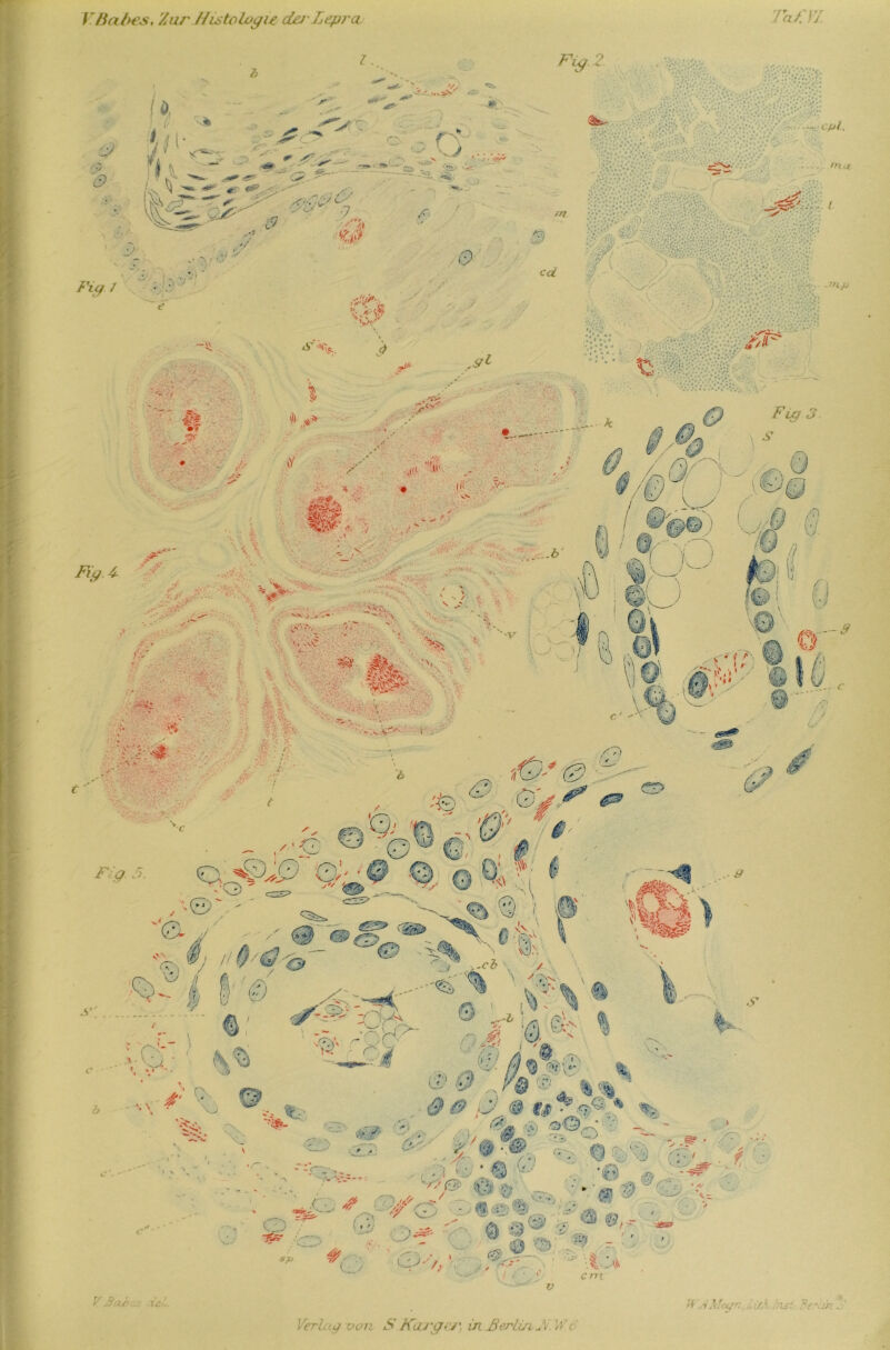 VBabes, Zur //istolvgw cLj Lepra. TaL VI. Verl, uj von S Karger, in ßerliaV.. W(