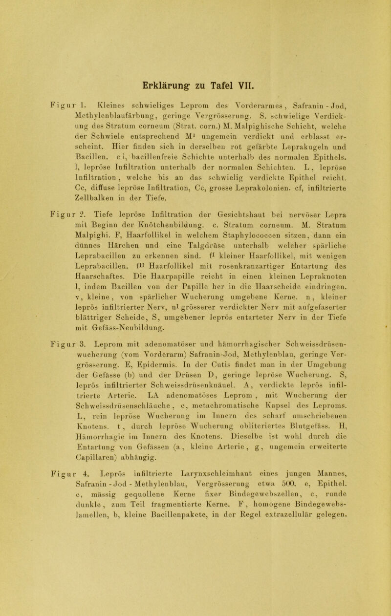 Figur 1. Kleines schwieliges Leprom des Vorderarmes, Safranin - Jod, Methylenblaufärbung, geringe Vergrösserung. S. schwielige Verdick- ung des Stratum corneum (Strat. corn.) M. Malpighische Schicht, welche der Schwiele entsprechend M1 ungemein verdickt und erblasst er- scheint. Hier linden sich in derselben rot gefärbte Leprakugeln und Bacillen, c i, bacillenfreie Schichte unterhalb des normalen Epithels. 1, lepröse Infiltration unterhalb der normalen Schichten. L, lepröse Infiltration , welche bis an das schwielig verdickte Epithel reicht. Cc, diffuse lepröse Infiltration, Cc, grosse Leprakolonien, cf, infiltrierte Zellbalken in der Tiefe. Figur 2. Tiefe lepröse Infiltration der Gesicbtshaut bei nervöser Lepra mit Beginn der Knötchenbildung, c. Stratum corneum. M. Stratum Malpighi. F, Haarfollikel in welchem Staphylococcen sitzen, dann ein dünnes Härchen und eine Talgdrüse unterhalb welcher spärliche Leprabacillen zu erkennen sind. H kleiner Haarfollikel, mit wenigen Leprabacillen. f-U Haarfollikel mit rosenkranzartiger Entartung des Haarschaftes. Die Haarpapille reicht in einen kleinen Lepraknoten 1, indem Bacillen von der Papille her in die Haarscheide eindringen. v, kleine, von spärlicher Wucherung umgebene Kerne, n, kleiner leprös infiltrierter Nerv, nl grösserer verdickter Nerv mit aufgefaserter blättriger Scheide, S, umgebener leprös entarteter Nerv in der Tiefe mit Gefäss-Neubildung. Figur 3. Leprom mit adenomatöser und hämorrhagischer Schweissdrüsen- wucherung (vom Vorderarm) Safranin-Jod, Methylenblau, geringe Ver- grösserung. E, Epidermis. In der Cutis findet man in der Umgebung der Gefässe (b) und der Drüsen D, geringe lepröse Wucherung. S, leprös infiltrierter Schweissdrüsenknäuel. A, verdickte leprös infil- trierte Arterie. LA adenomatöses Leprom , mit Wucherung der Schweissdrüsensehläuche , c, metachromatische Kapsel des Leproms. L, rein lepröse Wucherung im Innern des scharf umschriebenen Knotens, t, durch lepröse Wucherung oblitcriertes Blutgefäss. H, Hämorrhagie im Innern des Knotens. Dieselbe ist wohl durch die Entartung von Gefässen (a, kleine Arterie, g, ungemein erweiterte Oapillaren) abhängig. Figur 4. Leprös infiltrierte Larynxschleimhaut eines jungen Mannes, Safranin - Jod - Methylenblau, Vergrösserung etwa 500. e, Epithel, c, mässig gequollene Kerne fixer Bindegewebszellen, c, runde dunkle, zum Teil fragmentierte Kerne. F, homogene Bindegewebs- Jamellcn, b, kleine Bacillenpakete, in der Regel extrazellulär gelegen.