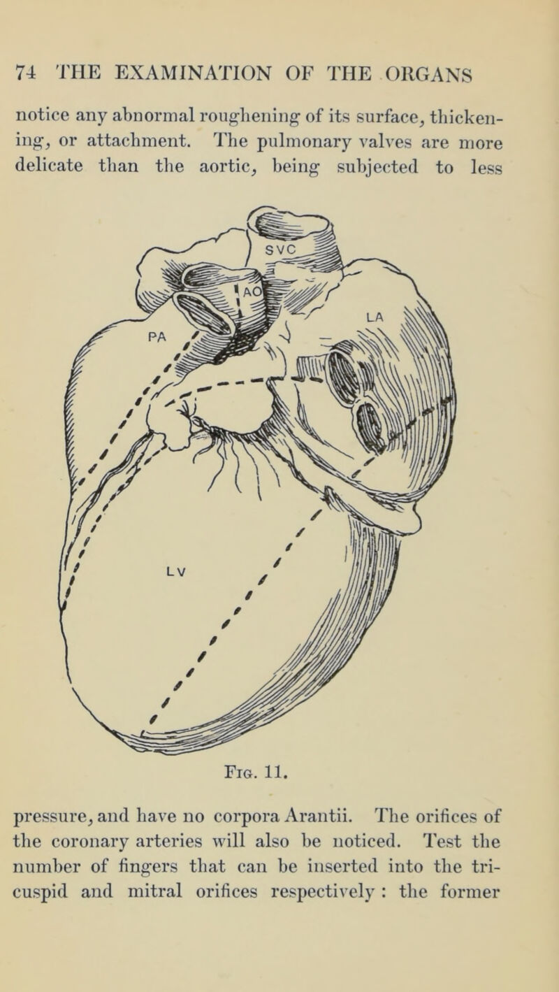 notice any abnormal roughening of its surface, thicken- ing, or attachment. Tlie pulmonary valves are more delicate than tlie aortic, being subjected to less Fig. 11. pressure, and have no corpora Arantii. The orifices of the coronary arteries will also he noticed. Test the number of fingers that can he inserted into the tri- cuspid and mitral orifices respectively : the former