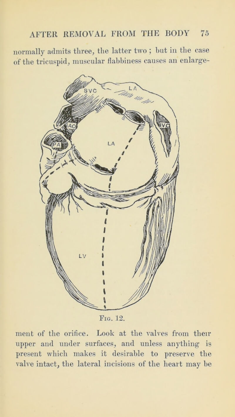 normally admits three, the latter two ; hut in the case of the tricuspid, muscular flabbiness causes an enlarge- ment of the orifice. Look at the valves from their upper and under surfaces, and unless anything is present which makes it desirable to preserve the valve intact, the lateral incisions of the heart may he