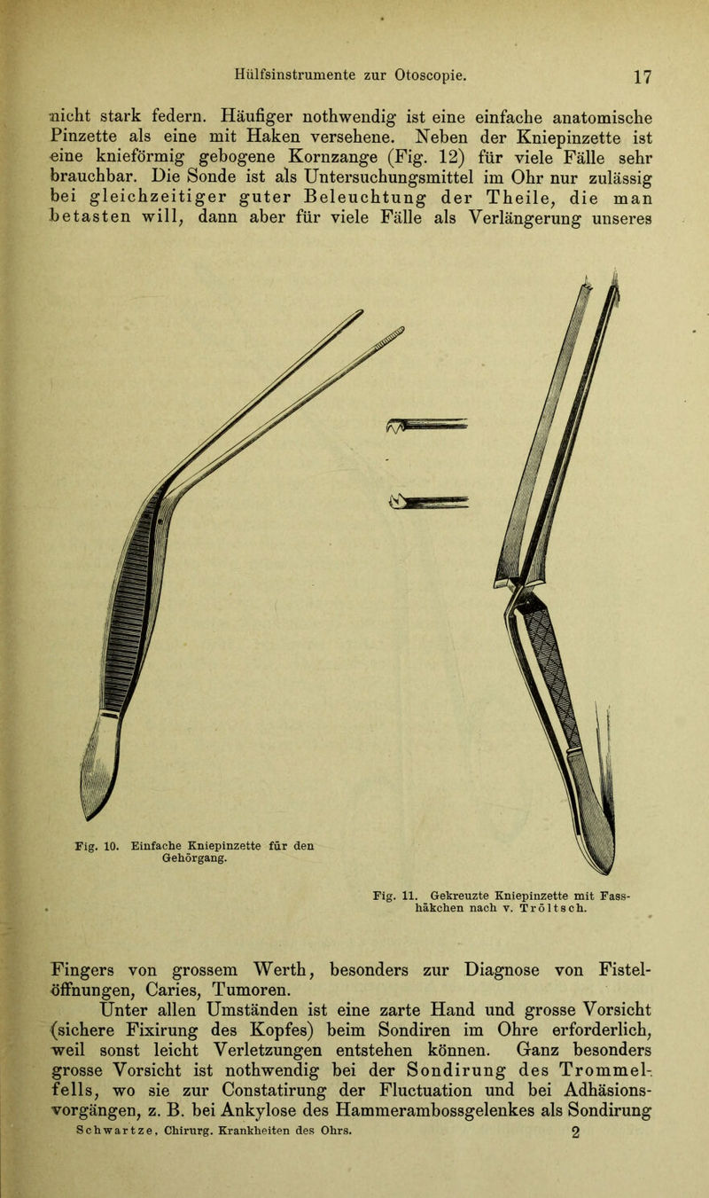 Glicht stark federn. Häufiger nothwendig ist eine einfache anatomische Pinzette als eine mit Haken versehene. Neben der Kniepinzette ist eine knieförmig gebogene Kornzange (Fig. 12) für viele Fälle sehr brauchbar. Die Sonde ist als Untersuchungsmittel im Ohr nur zulässig bei gleichzeitiger guter Beleuchtung der Theile, die man betasten will, dann aber für viele Fälle als Verlängerung unseres Fig. 11. Gekreuzte Kniepinzette mit Fass- häkchen nach v. Tröltsch. Fingers von grossem Werth, besonders zur Diagnose von Fistel- Öffnungen, Caries, Tumoren. Unter allen Umständen ist eine zarte Hand und grosse Vorsicht (sichere Fixirung des Kopfes) beim Sondiren im Ohre erforderlich, weil sonst leicht Verletzungen entstehen können. Ganz besonders grosse Vorsicht ist nothwendig bei der Sondirung des Trommel- fells, wo sie zur Constatirung der Fluctuation und bei Adhäsions- vorgängen, z. B. bei Ankylose des Hammerambossgelenkes als Sondirung Schwartze, Chirurg. Krankheiten des Ohrs. 2