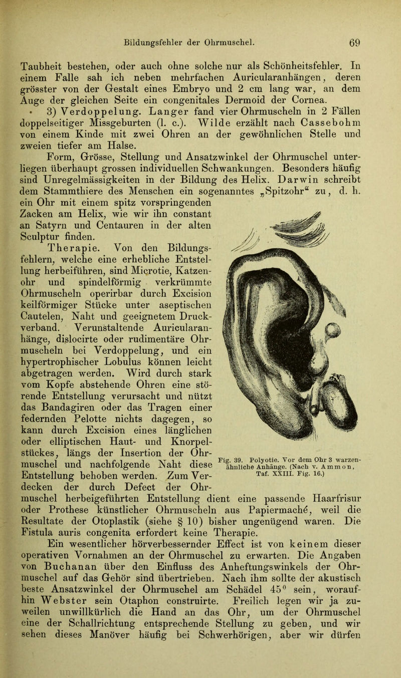 Taubheit bestehen, oder auch ohne solche nur als Schönheitsfehler. In einem Falle sah ich neben mehrfachen Auricularanhängen, deren grösster von der Gestalt eines Embryo und 2 cm lang war, an dem Auge der gleichen Seite ein congenitales Dermoid der Cornea. • 3) Verdoppelung. Langer fand vier Ohrmuscheln in 2 Fällen doppelseitiger Missgeburten (1. c.). Wilde erzählt nach Cassebohm von einem Kinde mit zwei Ohren an der gewöhnlichen Stelle und zweien tiefer am Halse. Form, Grösse, Stellung und Ansatzwinkel der Ohrmuschel unter- liegen überhaupt grossen individuellen Schwankungen. Besonders häufig sind Unregelmässigkeiten in der Bildung des Helix. Darwin schreibt dem Stammthiere des Menschen ein sogenanntes „Spitzohr“ zu, d. h. ein Ohr mit einem spitz vorspringenden Zacken am Helix, wie wir ihn constant an Satyrn und Centauren in der alten Sculptur finden. Therapie. Von den Bildungs- fehlern, welche eine erhebliche Entstel- lung herbeiführen, sind Microtie, Katzen- ohr und spindelförmig verkrümmte Ohrmuscheln operirbar durch Excision keilförmiger Stücke unter aseptischen Cautelen, Naht und geeignetem Druck- verband. Verunstaltende Auricularan- hänge, dislocirte oder rudimentäre Ohr- muscheln bei Verdoppelung, und ein hypertrophischer Lobulus können leicht abgetragen werden. Wird durch stark vom Kopfe abstehende Ohren eine stö- rende Entstellung verursacht und nützt das Bandagiren oder das Tragen einer federnden Pelotte nichts dagegen, so kann durch Excision eines länglichen oder elliptischen Haut- und Knorpel- stückes, längs der Insertion der Ohr- muschel und nachfolgende Naht diese ähnliche Anhängl‘(NacT v° a mm oTT ’ Entstellung behoben werden. ZumVer- Taf.xxm.Fig.i6.) decken der durch Defect der Ohr- muschel herbeigeführten Entstellung dient eine passende Haarfrisur oder Prothese künstlicher Ohrmuscheln aus Papiermache, weil die Resultate der Otoplastik (siehe § 10) bisher ungenügend waren. Die Fistula auris congenita erfordert keine Therapie. Ein wesentlicher hörverbessernder Effect ist von keinem dieser operativen Vornahmen an der Ohrmuschel zu erwarten. Die Angaben von Buchanan über den Einfluss des Anheftungswinkeis der Ohr- muschel auf das Gehör sind übertrieben. Nach ihm sollte der akustisch beste Ansatzwinkel der Ohrmuschel am Schädel 45° sein, worauf- hin Webster sein Otaphon construirte. Freilich legen wir ja zu- weilen unwillkürlich die Hand an das Ohr, um der Ohrmuschel eine der Schallrichtung entsprechende Stellung zu geben, und wir sehen dieses Manöver häufig bei Schwerhörigen, aber wir dürfen