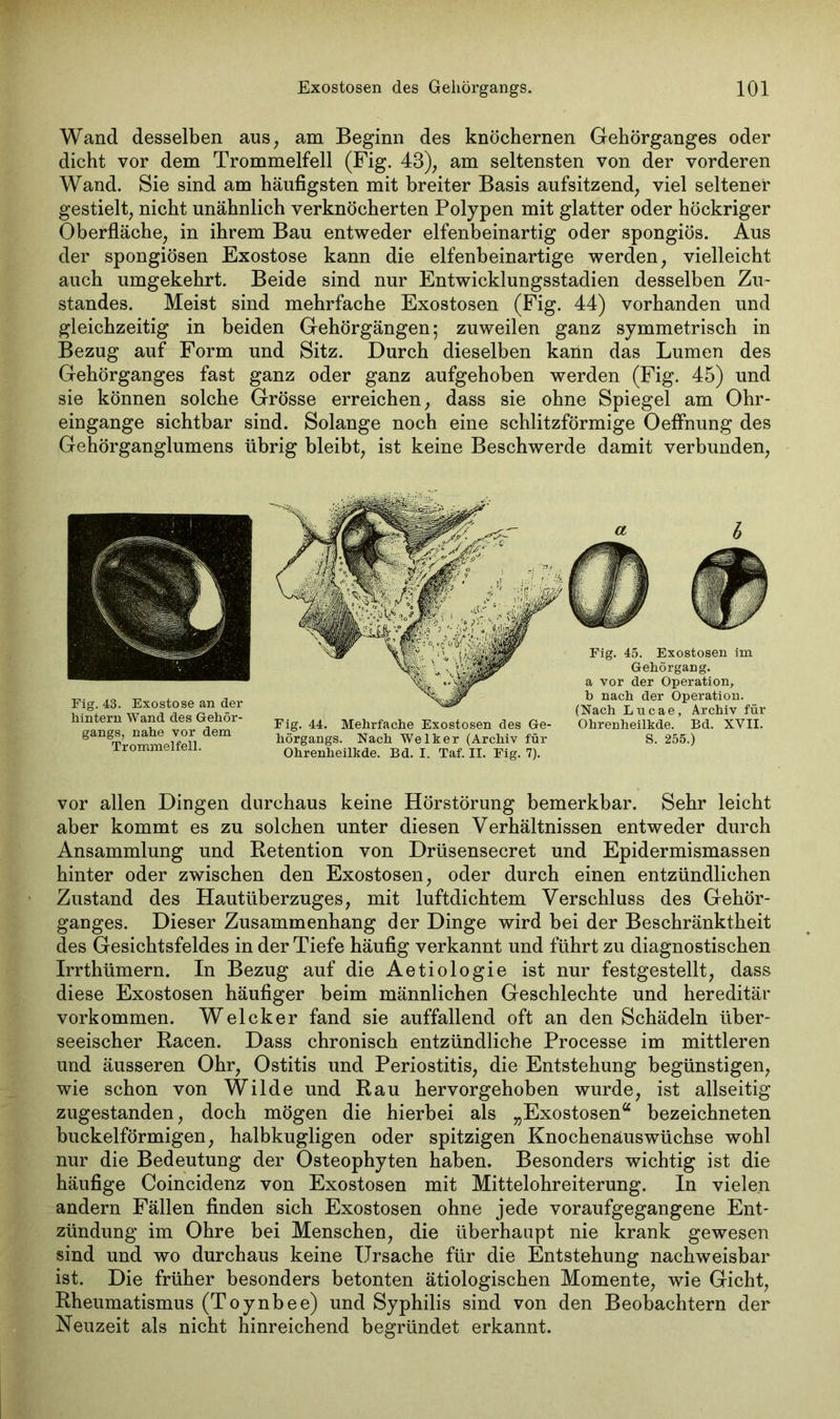 Wand desselben aus, am Beginn des knöchernen Gehörganges oder dicht vor dem Trommelfell (Fig. 43), am seltensten von der vorderen Wand. Sie sind am häufigsten mit breiter Basis aufsitzend, viel seltener gestielt, nicht unähnlich verknöcherten Polypen mit glatter oder höckriger Oberfläche, in ihrem Bau entweder elfenbeinartig oder spongiös. Aus der spongiösen Exostose kann die elfenbeinartige werden, vielleicht auch umgekehrt. Beide sind nur Entwicklungsstadien desselben Zu- standes. Meist sind mehrfache Exostosen (Fig. 44) vorhanden und gleichzeitig in beiden Gehörgängen; zuweilen ganz symmetrisch in Bezug auf Form und Sitz. Durch dieselben kann das Lumen des Gehörganges fast ganz oder ganz aufgehoben werden (Fig. 45) und sie können solche Grösse erreichen, dass sie ohne Spiegel am Ohr- eingange sichtbar sind. Solange noch eine schlitzförmige Oeffnung des Gehörganglumens übrig bleibt, ist keine Beschwerde damit verbunden, Fig. 43. Exostose an der hintern Wand des Gehör- gangs, nahe vor dem Trommelfell. Fig. 44. Mehrfache Exostosen des Ge- hörgangs. Nach Welker (Archiv für Ohrenheilkde. Bd. I. Taf. II. Fig. 7). Fig. 45. Exostosen im Gehörgang, a vor der Operation, b nach der Operation. (Nach Lncae, Archiv für Ohrenheilkde. Bd. XVII. S. 255.) vor allen Dingen durchaus keine Hörstörung bemerkbar. Sehr leicht aber kommt es zu solchen unter diesen Verhältnissen entweder durch Ansammlung und Retention von Drüsensecret und Epidermismassen hinter oder zwischen den Exostosen, oder durch einen entzündlichen Zustand des Hautüberzuges, mit luftdichtem Verschluss des Gehör- ganges. Dieser Zusammenhang der Dinge wird bei der Beschränktheit des Gesichtsfeldes in der Tiefe häufig verkannt und führt zu diagnostischen Irrthümern. In Bezug auf die Aetiologie ist nur festgestellt, dass diese Exostosen häufiger beim männlichen Geschlechte und hereditär Vorkommen. Welcker fand sie auffallend oft an den Schädeln über- seeischer Racen. Dass chronisch entzündliche Processe im mittleren und äusseren Ohr, Ostitis und Periostitis, die Entstehung begünstigen, wie schon von Wilde und Rau hervorgehoben wurde, ist allseitig zugestanden, doch mögen die hierbei als „Exostosen“ bezeichneten buckelförmigen, halbkugligen oder spitzigen Knochenauswüchse wohl nur die Bedeutung der Osteophyten haben. Besonders wichtig ist die häufige Coincidenz von Exostosen mit Mittelohreiterung. In vielen andern Fällen finden sich Exostosen ohne jede voraufgegangene Ent- zündung im Ohre bei Menschen, die überhaupt nie krank gewesen sind und wo durchaus keine Ursache für die Entstehung nachweisbar ist. Die früher besonders betonten ätiologischen Momente, wie Gicht, Rheumatismus (Toynbee) und Syphilis sind von den Beobachtern der Neuzeit als nicht hinreichend begründet erkannt.