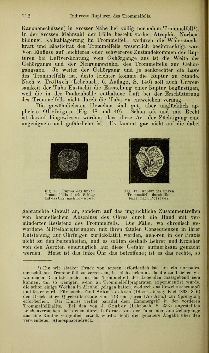 Kanonenschüssen) in grosser Nähe bei völlig normalem Trommelfell1). In der grossen Mehrzahl der Fälle besteht vorher Atrophie, Narben- bildung, Kalkablagerung im Trommelfell, wodurch die Widerstands- kraft und Elasticität des Trommelfells wesentlich beeinträchtigt war. Von Einfluss auf leichteres oder schwereres Zustandekommen der Rup- turen bei Liiftverdichtung vom Gehörgange aus ist die Weite des Gehörgangs und der Neigungswinkel des Trommelfells zur Gehör- gangsaxe. Je weiter der Gehörgang und je senkrechter die Lage des Trommelfells ist, desto leichter kommt die Ruptur zu Stande. Nach v. Tröltsch (Lehrbuch, 6. Auflage, S. 146) soll auch Unweg- samkeit der Tuba Eustachii die Entstehung einer Ruptur begünstigen, weil die in der Paukenhöhle enthaltene Luft bei der Erschütterung des Trommelfells nicht durch die Tuba zu entweichen vermag. Die gewöhnlichsten Ursachen sind gut, aber unglücklich ap- plicirte Ohrfeigen (Fig. 48 und 49). Schon oft und mit Recht ist darauf hingewiesen worden, dass diese Art der Züchtigung eine ungeeignete und gefährliche ist. Es kommt gar nicht auf die dabei Fig. 48. Ruptur des linken Trommelfells durch Schlag auf das Ohr, nach To y nb e e. Fig. 49. Ruptur des linken Trommelfells durch Ohr- feige, nach Politzer, gebrauchte Gewalt an, sondern auf das unglückliche Zusammentreffen von hermetischem Abschluss des Ohres durch die Hand mit ver- minderter Resistenz des Trommelfells. Die Fälle, wo chronisch ge- wordene Mittelohrejterungen mit ihren fatalen Consequenzen in ihrer Entstehung auf Ohrfeigen zurückdatirt werden, gehören in der Praxis nicht zu den Seltenheiten, und es sollten deshalb Lehrer und Erzieher von den Aerzten eindringlich auf diese Gefahr aufmerksam gemacht werden. Meist ist das linke Ohr das betroffene; ist es das rechte, so J) Ein wie starker Druck von aussen erforderlich ist, um ein normales, menschliches Trommelfell zu zerreissen, ist nicht bekannt, da die an Leichen ge- wonnenen Resultate nicht für das Trommelfell des Lebenden massgebend sein können, um so weniger, wenn an Trommelfellpräparaten experimentirt wurde, die schon einige Wochen in Alcohol gelegen hatten, wodurch das Gewebe schrumpft und fester wird. Für solche fand Schmiedekam (Dissert. inaug. Kiel 1868. S. 6) den Druck einer Quecksilbersäule von 143 cm (circa 1,75 Atm.) zur Sprengung erforderlich. Der Einriss verlief parallel dem Hammergriff in der vorderen Trommelfellhälfte. Bei den von J. Gr über (Lehrbuch. S. 333) angestellten Leichenversuchen, bei denen durch Luftdruck von der Tuba oder vom Gehörgange aus eine Ruptur vergeblich erzielt wurde, fehlt die genauere Angabe über den verwendeten Atmosphärendruck.