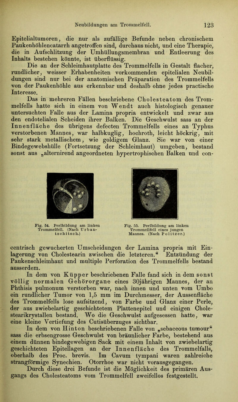 Epitelialtumoren, die nur als zufällige Befunde neben chronischem Paukenhöhlencatarrh angetroffen sind, durchaus nicht, und eine Therapie, die in Aufschlitzung der Umhüllungsmembran und Entleerung des Inhalts bestehen könnte, ist überflüssig. Die an der Schleimhautplatte des Trommelfells in Gestalt flacher, rundlicher, weisser Erhabenheiten vorkommenden epitelialen Neubil- dungen sind nur bei der anatomischen Präparation des Trommelfells von der Paukenhöhle aus erkennbar und deshalb ohne jedes practische Interesse. Das in mehreren Fällen beschriebene Cholesteatom des Trom- melfells hatte sich in einem von Wendt auch histologisch genauer untersuchten Falle aus der Lamina propria entwickelt und zwar aus den endotelialen Scheiden ihrer Balken. Die Geschwulst sass an der Innenfläche des übrigens defecten Trommelfells eines an Typhus verstorbenen Mannes, war halbkuglig, hochroth, leicht höckrig, mit sehr stark metallischem, wie goldigem Glanz. Sie war von einer Bindegewebshülle (Fortsetzung der Schleimhaut) umgeben, bestand sonst aus „alternirend angeordneten hypertrophischen Balken und con- Fig. 54. Perlbildung am linken Trommelfell. (Nach Urban- tschitscb.) Fig. 55. Perlbildung am linken Trommellfell eines jungen Mannes. (Nach Politzer.) centrisch gewucherten Umscheidungen der Lamina propria mit Ein- lagerung von Cholestearin zwischen die letzteren.“ Entzündung der Paukenschleimhaut und multiple Perforation des Trommelfells bestand ausserdem. In dem von Küpper beschriebenen Falle fand sich in dem sonst völlig normalen Gehörorgane eines 30jährigen Mannes, der an Phthisis pulmonum verstorben war, nach innen und unten vom Umbo ein rundlicher Tumor von 1,5 mm im Durchmesser, der Aussenfläche des Trommelfells lose aufsitzend, von Farbe und Glanz einer Perle, der aus zwiebelartig geschichtetem Plattenepitel und einigen Chole- stearikrystallen bestand. Wo die Geschwulst aufgesessen hatte, war eine kleine Vertiefung des Cutisüberzuges sichtbar. In dem von Hinton beschriebenen Falle von „sebaceous tumour“ sass die erbsengrosse Geschwulst von bräunlicher Farbe, bestehend aus einem dünnen bindegewebigen Sack mit einem Inhalt von zwiebelartig geschichteten Epitellagen an der Innenfläche des Trommelfalls, oberhalb des Proc. brevis. Im Cavum tympani waren zahlreiche strangförmige Synechien. Otorrhoe war nicht vorausgegangen. Durch diese drei Befunde ist die Möglichkeit des primären Aus- gangs des Cholesteatoms vom Trommelfell zweifellos festgestellt.