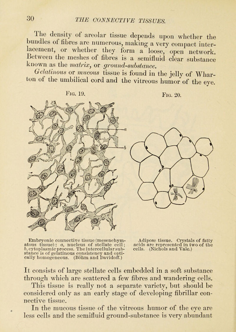 The density of areolar tissue depends upon whether the bundles of fibres are numerous, making a very compact inter- lacement, or whether they form a loose, open network, lietween the meshes of fibres is a semifiuid clear substance known as the matrix, or ground-substance. Gelatinous or mucous tissue is found in the jelly of Whar- ton of the umbilical cord and the vitreous humor of the eye. Fig. 19. Fig. 20. Embryonic connective tissue (mesenchym- Adipose tissue. Crystals of fatty atons tissuel: a, nucleus of stellate cell; acids are represented in two of the b, cytoplasmic process. The intercellular sub- cells. (Nichols and Vale.) stance is of gelatinous consistency and opti- cally homogeneous. (Bohm and bavidoff.) It consists of large stellate cells embedded in a soft substance through which are scattered a few fibres and wandering cells. This tissue is really not a separate variety, but should be considereid only as an early stage of developing fibrillar con- nective tissue. In the mucous tissue of the vitreous humor of the eye are less cells and the semifluid ground-substance is very abundant