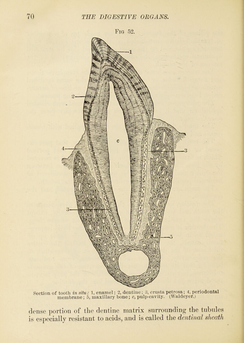 Fig 52. Section of tooth in situ: 1, enamel; 2, dentine; 3, crusta petrosa; 4, periodontal membrane ; 5, maxillary bone; c, pulp-cavity. (Waldeyer.) dense portion of tlie dentine matrix surrounding the tnbnles is especially resistant to acids^ and is called the dentinal sheath