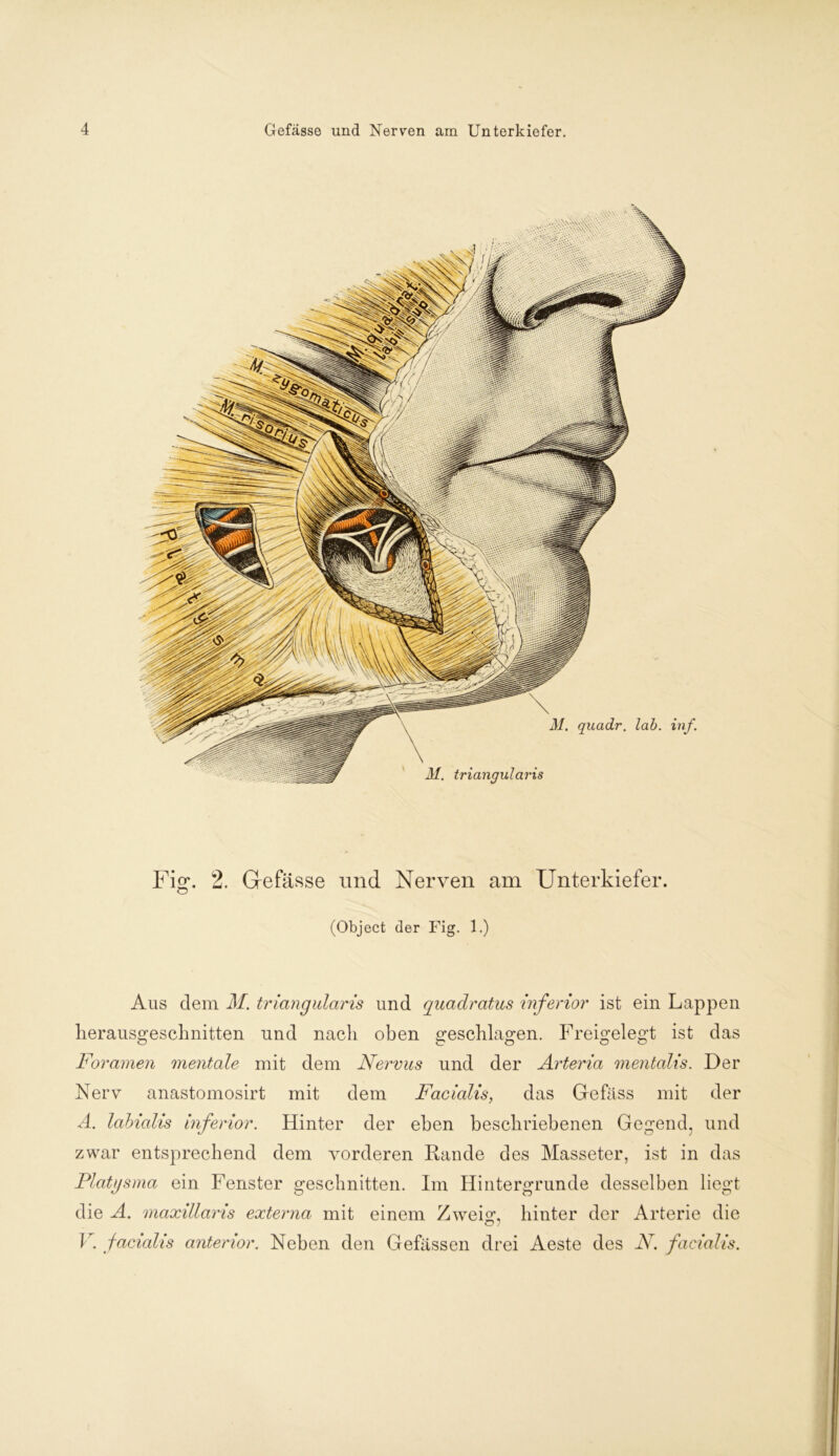 Fig\ 2. Gefässe und Nerven am Unterkiefer. O (Object der Fig. 1.) Aus dem M. triangularis und quadratus inferior ist ein Lappen lierausgeschnitten und nach oben geschlagen. Freigelegt ist das Foramen mentale mit dem Nervus und der Arteria mentalis. Der Nerv anastomosirt mit dem Facialis, das Ge fass mit der A. labialis inferior. Hinter der eben beschriebenen Gegend, und zwar entsprechend dem vorderen Rande des Masseter, ist in das Platysma ein Fenster geschnitten. Im Hintergründe desselben liegt die A. maxillaris externa mit einem Zwei«*, hinter der Arterie die V. facialis anterior. Neben den Gefässen drei Aeste des N. facialis.