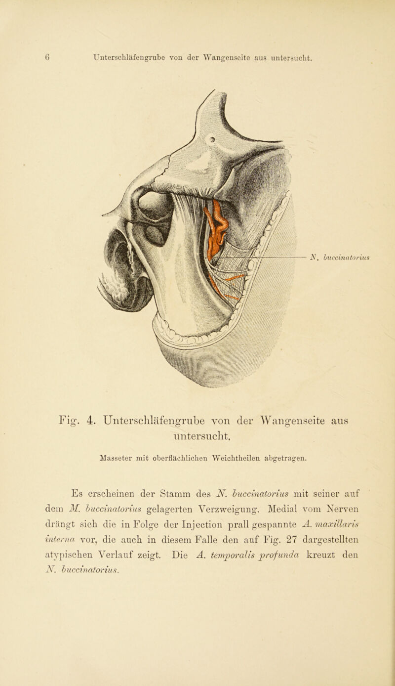 Fig-. 4. Unterschläfengrube von der Wangenseite aus untersucht. Masseter mit oberflächlichen Weichtheilen abgetragen. Es erscheinen der Stamm des N. buccinatorius mit seiner auf dem M. buccinatorius gelagerten Verzweigung. Medial vom Nerven drängt sich die in Folge der Injection prall gespannte A. maxillaris interna vor, die auch in diesem Falle den auf Fig. 27 dargestellten atypischen Verlauf zeigt. Die A. temporalis profunda kreuzt den N. buccinatorius.