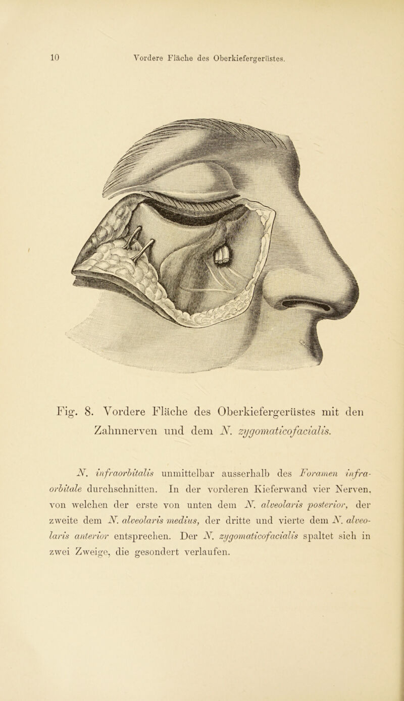 Vordere Fläche des Oberkiefergeriistes. Vordere Fläche des Oberkiefero'erüstes mit den O Zahnnerven und dem N. zygomaticofacialis. N. infraorbitalis unmittelbar ausserhalb des Foramen infra- orbitale durchschnitten. In der vorderen Kieferwand vier Nerven, von welchen der erste von unten dem N. alveolaris posterior, der zweite dem N. alveolaris medius, der dritte und vierte dem N. alveo- laris anterior entsprechen. Der N. zygomaticofacialis spaltet sich in zwei Zweige, die gesondert verlaufen.