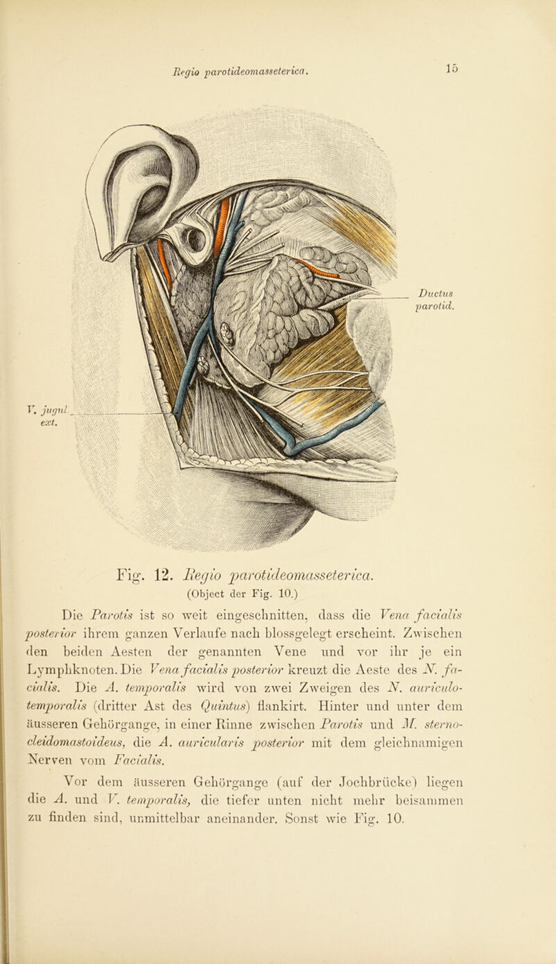 V. jugrd ext. Ductus parotid. Fig. 12. Begio parotideomasseterica. (Object der Fig. 10.) Die Parotis ist so weit eingeschnitten, dass die Vena facialis posterior ihrem ganzen Verlaufe nach blossgelegt erscheint. Zwischen den beiden Aesten der genannten Vene und vor ihr je ein Lymphknoten. Die Vena facialis posterior kreuzt die Aeste des N. fa- cialis. Die A. temporalis wird von zwei Zweigen des N. auriculo- temporalis (dritter Ast des Quintus) flankirt. Hinter und unter dem äusseren Gekürgange, in einer Rinne zwischen Parotis und M. sterno- cleidomastoideus, die A. auricularis posterior mit dem gleichnamigen Nerven vom Facialis. Vor dem äusseren Gekürgange (auf der Jochbrücke) liegen die A. und V. temporalis, die tiefer unten nicht mehr beisammen zu finden sind, unmittelbar aneinander. Sonst wie Fisr. 10.