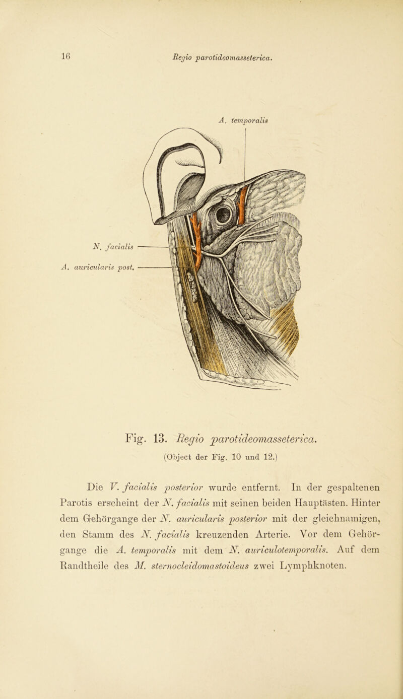 A. temporalis N. facialis A. auricularis post. Fig\ 13. lieg io parotideomasseterica. (Object der Fig\ 10 und 12.) Die V. facialis posterior wurde entfernt. In der gespaltenen Parotis ers'clieint der N. facialis mit seinen beiden Hauptästen. Hinter dem Gehörgange der N. auricularis posterior mit der gleichnamigen, den Stamm des N. facialis kreuzenden Arterie. Vor dem Gehör- gange die A. temporalis mit dem N. auriculotemporalis. Auf dem Randtheile des M. sternocleidomastoideus zwei Lymphknoten.