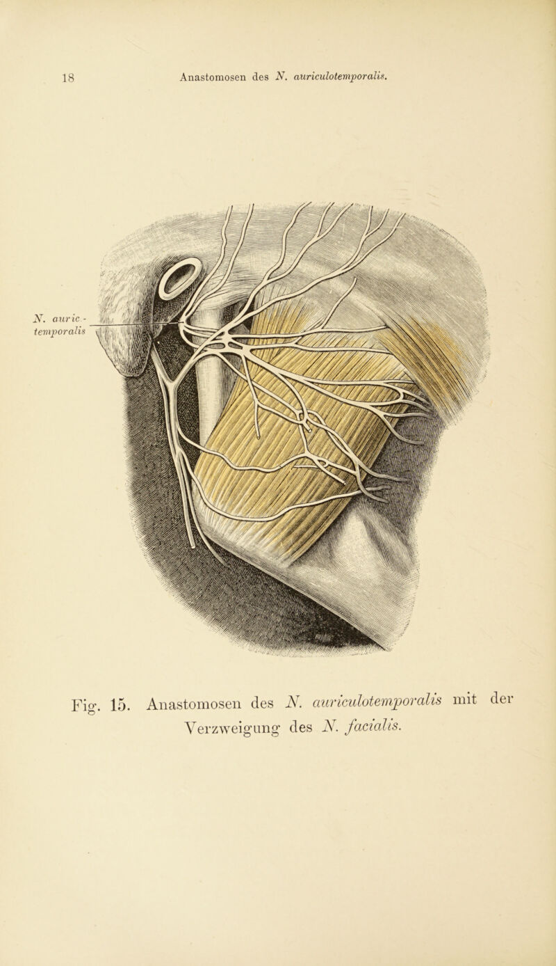 Fi°\ 15. Anastomosen des N. auriculotemjooralis mit der Ö * Verzweigung des N. facialis.