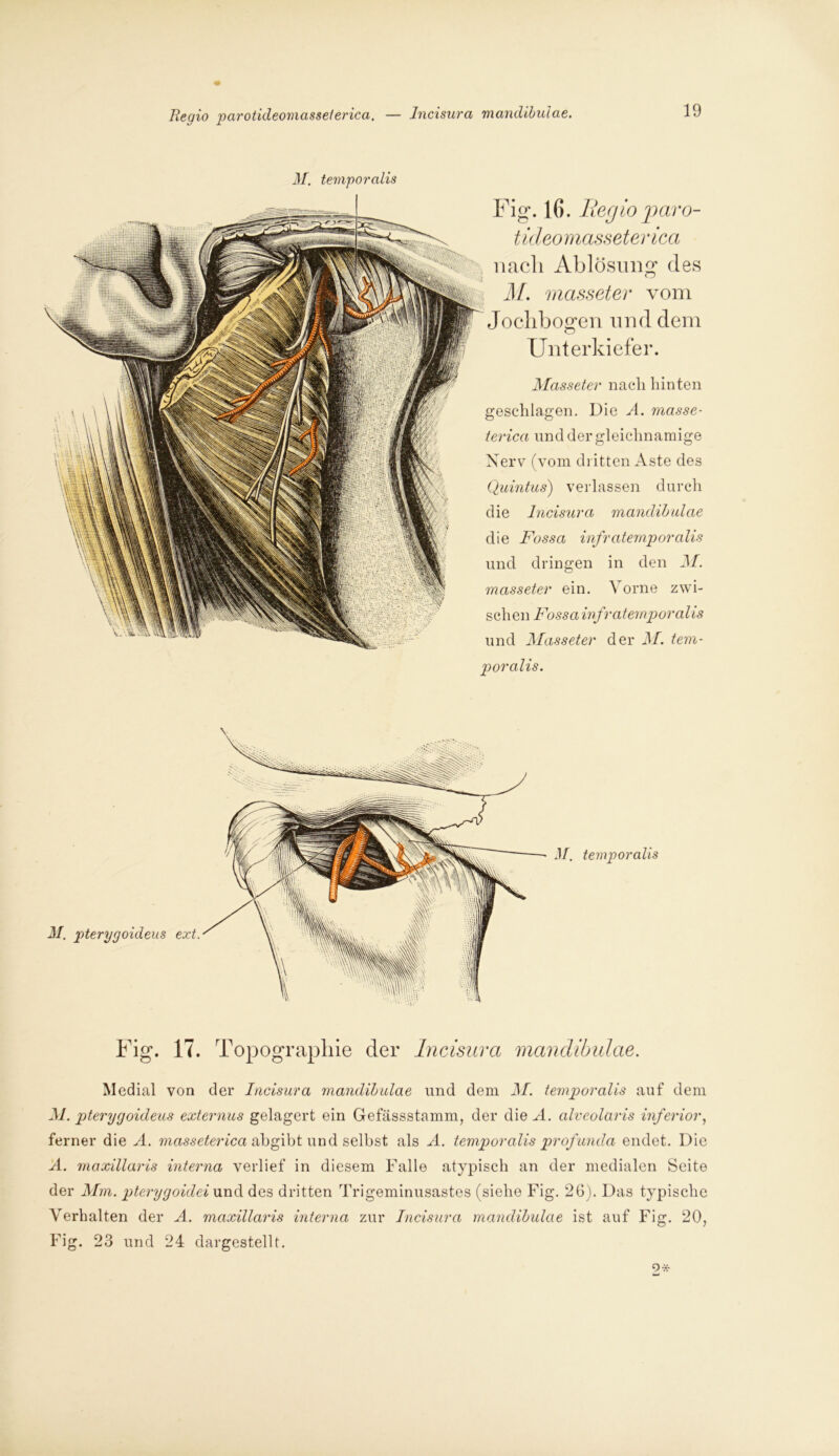 Begio parotideomasseierica. — lncisura mandibulae. M. temporcilis Fig. 16. Regio paro- tideo masseterica nach Ablösung des M. masseter vom Jochbogen und dem Unterkiefer. Masseter nach hinten geschlagen. Die A. masse- terica und der gleichnamige Nerv (vom dritten Aste des Quintus) verlassen durch die lncisura mandibulae die Fossa infraternporalis und dringen in den M. masseter ein. Vorne zwi- schen Fossa infraternporalis und Masseter der M. tem- poralis. Fig. 17. Topographie der lncisura mandibulae. Medial von der lncisura mandibulae und dem M. temporalis auf dem M. pterygoideus externus gelagert ein Gefässstamm, der die A. alveolaris inferior, ferner die A. masseterica abgibt und selbst als A. temporalis profunda endet. Die A. maxillaris interna verlief in diesem Falle atypisch an der medialen Seite der Mm. pterygoidei und des dritten Trigeminusastes (siehe Fig. 26). Das typische Verhalten der A. maxillaris interna zur lncisura mandibulae ist auf Fig. 20, Fig. 23 und 24 dargestellt. 9*