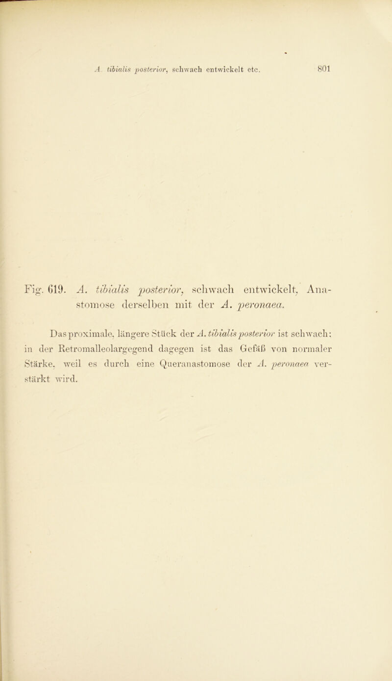 Fig. 619. A. tibialis posterior} schwach entwickelt. Ärm- stem ose derselben mit der A. peronaea. Das proximale, längere Stück der A. tibialis posterior ist schwach: in der Retromalleolargegend dagegen ist das Gefäß von normaler Stärke, weil es durch eine Queranastomose der A. peronaea ver- stärkt wird.