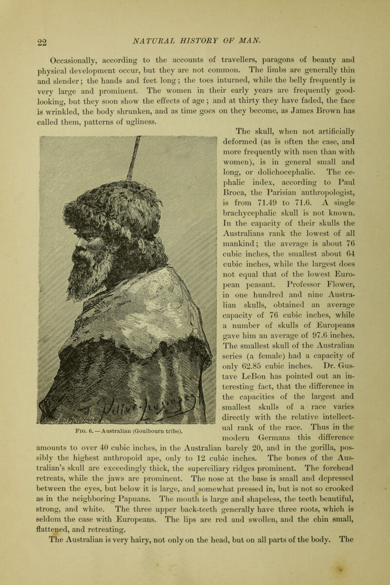 Occasionally, according to the accounts of travellers, j)aragons of beauty and physical develojmrent occur, but they are not coinnion. The limbs are generally tliin and slender; the hands and feet long; the toes intunied, while the belly frequently is very large and prominent. The women in their early years are frequently good- looking, but they soon show the effects of age ; and at thirty they have faded, the face is wrinkled, the body shrunken, and as time goes on they become, as James Brown has called them, patterns of ugliness. Tlie skull, when not artificially deformed (as is often the case, and more frequently with men than with women), is in general small and long, or dolichocephalic. The ce- phalic index, according to Paul Broca, the Parisian anthroj)ologist, is from 71.49 to 71.G. A single brachycephalic skull is not known. In the capacity of their skulls the Australians rank the lowest of all mankind; the average is about 76 cubic inches, the smallest about G4 cubic inches, while the largest does not equal that of the lowest Euro- ])ean peasant. Professor Flower, in one hundred and nine Austi'a- lian skulls, obtained an average capacity of 76 cubic inches, while a number of skulls of Europeans gave him an average of 97.6 inches. The smallest skull of the Australian series (a female) had a capacity of only 62.85 cubic inches. Dr. Gus- tave LeBon has pointed out an in- teresting fact, that the difference in the capacities of the lai-gest and smallest skulls of a race varies directly with the relative intellect- ual rank of the race. Thus in the modern Germans this difference amounts to over 40 cubic inches, in the Australian barely 20, and in the gorilla, ])o.s- sibly the highest anthropoid ape, only to 12 cubic inches. The bones of the Aus- tralian’s skull are exceedingly thick, the superciliary ridges prominent. The forehead retreats, while the jaws are jn’orninent. The nose at the base is small and depressed between the eyes, but below it is large, and somewhat pressed in, but is not so crooked as in the neighboring Papuans. The mouth is large and shapeless, the teeth beautiful, strong, and white. The three upper back-teeth generally have three roots, which is seldom the case with Europeans. The li])S are red and swollen, and the chin small, flattened, and retreating. The Australian is very hairy, not only on the head, but on all parts of the body. The