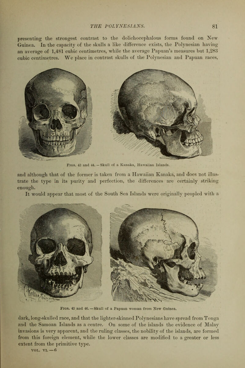 presenting the strongest contrast to the clolichocephalous forms found on New Guinea. In the capacity of tlie skulls a like difference exists, the Polynesian having an average of 1,481 cubic centimetres, while the average Papuan’s measures but 1,288 cubic centimetres. We place in contrast skulls of the Polynesian and Papuan races. Figs. 43 ami 44. — Skull of a Kanaka, Hawaiian Islamls. and although that of the former is taken from a Hawaiian Kanaka, and does not illus- trate the tyjie in its jiiirity and perfection, the differences are certainly striking enough. It would appear that most of the South Sea Islands were originally peopled with a Figs. 45 and 46.—Skull of a Papuan woman from New Guinea. dark, long-skulled race, and that the lighter-skinned Polynesians have spread from Tonga and the Samoan Islands as a centre. On some of the islands the evidence of Malay invasions is very apparent, and the ruling classes, the nobility of the islands, are formed from this foreign element, while the lower classes are modified to a greater or less extent from the jirimitive ty23e. VOL. VI.—6