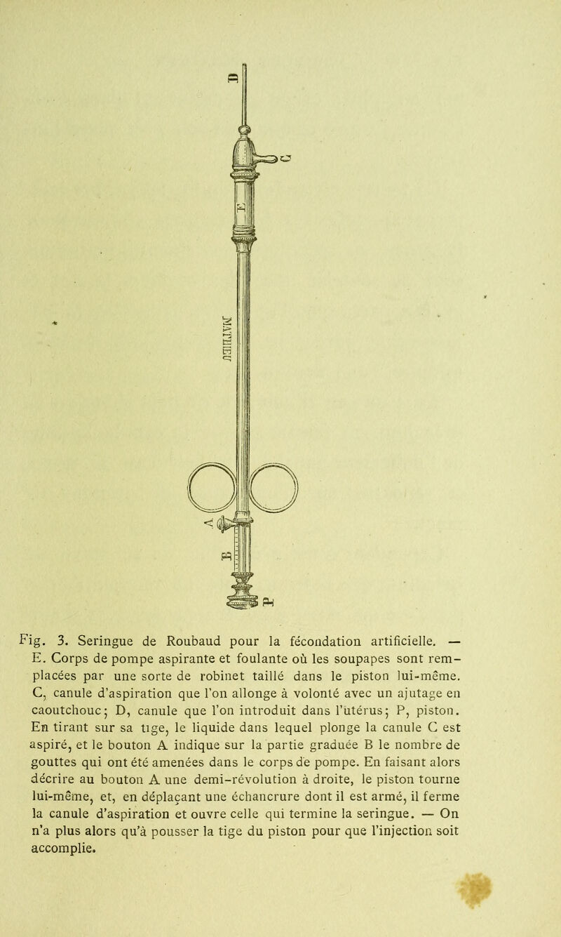 Fig. 3. Seringue de Roubaud pour la fécondation artificielle. — E. Corps de pompe aspirante et foulante où les soupapes sont rem- placées par une sorte de robinet taillé dans le piston lui-même. C, canule d’aspiration que l’on allonge à volonté avec un ajutage en caoutchouc5 D, canule que l’on introduit dans l’utérus; P, piston. En tirant sur sa tige, le liquide dans lequel plonge la canule C est aspiré, et le bouton A indique sur la partie graduée B le nombre de gouttes qui ont été amenées dans le corps dé pompe. En faisant alors décrire au bouton A une demi-révolution à droite, le piston tourne lui-même, et, en déplaçant une échancrure dont il est armé, il ferme la canule d’aspiration et ouvre celle qui termine la seringue. — On n’a plus alors qu’à pousser la tige du piston pour que l’injection soit accomplie.