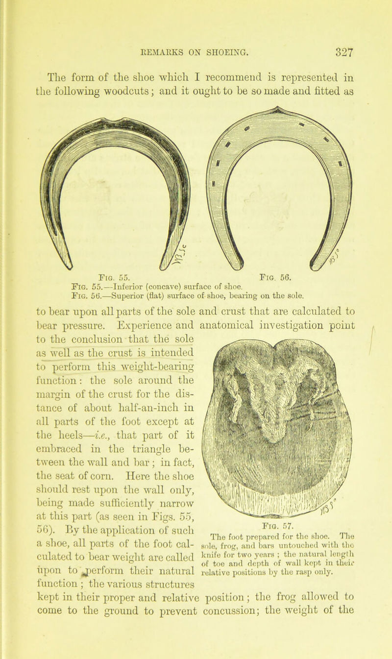 The form of the shoe which I recommend is represented in the following woodcuts; and it ought to be so made and fitted as Fig. 55.—Inferior (concave) surface of shoe. Fig. 56.—Superior (fiat) surface of shoe, bearing on the sole. to hear upon all parts of the sole and crust that are calculated to bear pressure. Experience and anatomical investigation point to the conclusion that the sole as well as the crust is intended to perform this weight-bearing function: the sole around the margin of the crust for the dis- tance of about lialf-an-inch in all parts of the foot except at the heels—i.c., that part of it embraced in the triangle he- tween the wall and bar ; in fact, the seat of corn. Here the shoe should rest upon the wall only, being made sufficiently narrow at this part (as seen in Figs. 55, 56). By the application of such a shoe, all parts of the foot cal- sole, frog, and bars untouched with tho culated to bear weight are called knife for ;r the natural length ° of toe and depth of wall kept in their upon to perform their natural relative positions by the rasp only. function ; the various structures kept in their proper and relative position; the frog allowed to come to the ground to prevent concussion; the weight of the Fig. 57. Tlit* font, nrpnnrprl for t/hfi fcliOfi. The