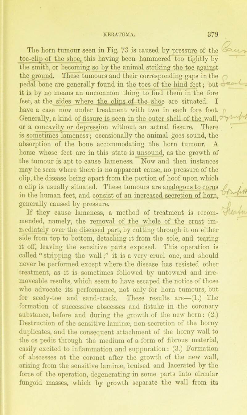 The horn tumour seen in Fig. 73 is caused by pressure of the toe-clip of the shoe, this having been hammered too tightly by the smith, or becoming so by the animal striking the toe against the ground. These tumours and their corresponding gaps in the pedal bone are generally found in the toes of the hind feet; but it is by no means an uncommon thing to find them in the fore feet, at the sides where the jdips of the shoe are situated. I have a case now under treatment with two in each fore foot. Generally, a kind of fissure is seen in the outer shell of the wall, or a concavity or depression without an actual fissure. There is sometimes lameness; occasionally the animal goes sound, the absorption of the bone accommodating the horn tumour. A horse whose feet are in this state is unsound, as the growth of the tumour is apt to cause lameness. Now and then instances may be seen where there is no apparent cause, no pressure of the clip, the disease being apart from the portion of hoof upon which a clip is usually situated. These tumours are analogous to corns in the human feet, and consist of an increased secretion of horn, generally caused by pressure. If they cause lameness, a method of treatment is recom- mended, namely, the removal of .the whole of the crust im- mediately over the diseased part, by cutting through it on either side from top to bottom, detaching it from the sole, and tearing it off, leaving the sensitive parts exposed. This operation is called “stripping the wall;” it is a very cruel one, and should never be performed except where the disease has resisted other treatment, as it is sometimes followed by untoward and irre- moveable results, which seem to have escaped the notice of those who advocate its performance, not only for horn tumours, but for seedy-toe and sand-crack. These results are—(1.) The formation of successive abscesses and fistula3 in the coronary substance, before and during the growth of the new horn: (2.) Destruction of the sensitive laminae, non-secretion of the horny duplicates, and the consequent attachment of the horny wall to the os pedis through the medium of a form of fibrous material, easily excited to inflammation and suppuration: (3.) Formation of abscesses at the coronet after the growth of the new wall, arising from the sensitive laminae, bruised and lacerated by the force of the operation, degenerating in some parts into circular fungoid masses, which by growth separate the wall from its