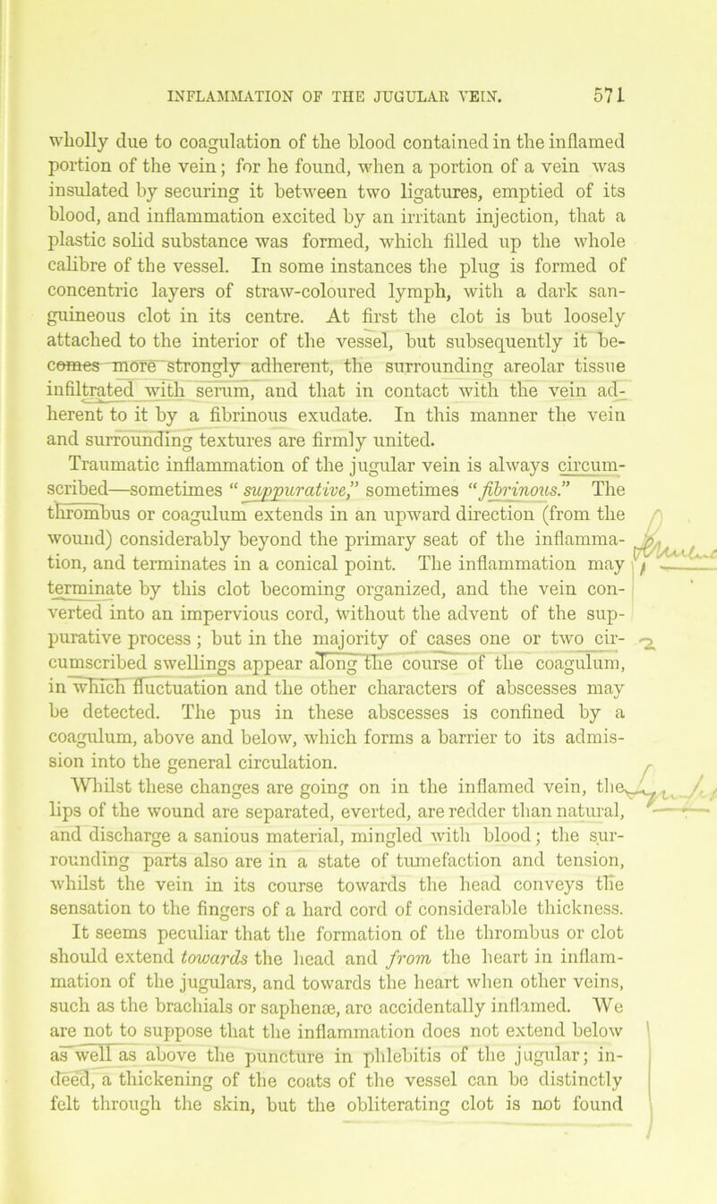 wholly due to coagulation of the blood contained in the inflamed portion of the vein; for he found, when a portion of a vein was insulated by securing it between two ligatures, emptied of its blood, and inflammation excited by an irritant injection, that a plastic solid substance was formed, which filled up the whole calibre of the vessel. In some instances the plug is formed of concentric layers of straw-coloured lymph, with a dark san- guineous clot in its centre. At first the clot is but loosely attached to the interior of the vessel, but subsequently it be- comes-more'strongly adherent, the surrounding areolar tissue infiltrated with serum, and that in contact with the vein ad- herent to it by a fibrinous exudate. In this manner the vein and surrounding textures are firmly united. Traumatic inflammation of the jugular vein is always circum- scribed—sometimes “ suppurative” sometimes “fibrinousThe thrombus or coagulum extends in an upward direction (from the wound) considerably beyond the primary seat of the inflamma- tion, and terminates in a conical point. The inflammation may terminate by this clot becoming organized, and the vein con- verted into an impervious cord, without the advent of the sup- purative process; but in the majority of cases one or two cir- cumscribed swellings appear along-'the course of the coagulum, in which fluctuation and the other characters of abscesses may be detected. The pus in these abscesses is confined by a coagulum, above and below, which forms a barrier to its admis- sion into the general circulation. Whilst these changes are going on in the inflamed vein, the^^, lips of the wound are separated, everted, are redder than natural, and discharge a sanious material, mingled with blood; the sur- rounding parts also are in a state of tumefaction and tension, whilst the vein in its course towards the head conveys tile sensation to the fingers of a hard cord of considerable thickness. It seems peculiar that the formation of the thrombus or clot should extend towards the head and from the heart in inflam- mation of the jugulars, and towards the heart when other veins, such as the brachials or saphenae, are accidentally inflamed. We are not to suppose that the inflammation does not extend below 5 aiTwell as above the puncture in phlebitis of the jugular; in- deed, a thickening of the coats of the vessel can be distinctly felt through the skin, but the obliterating clot is not found /