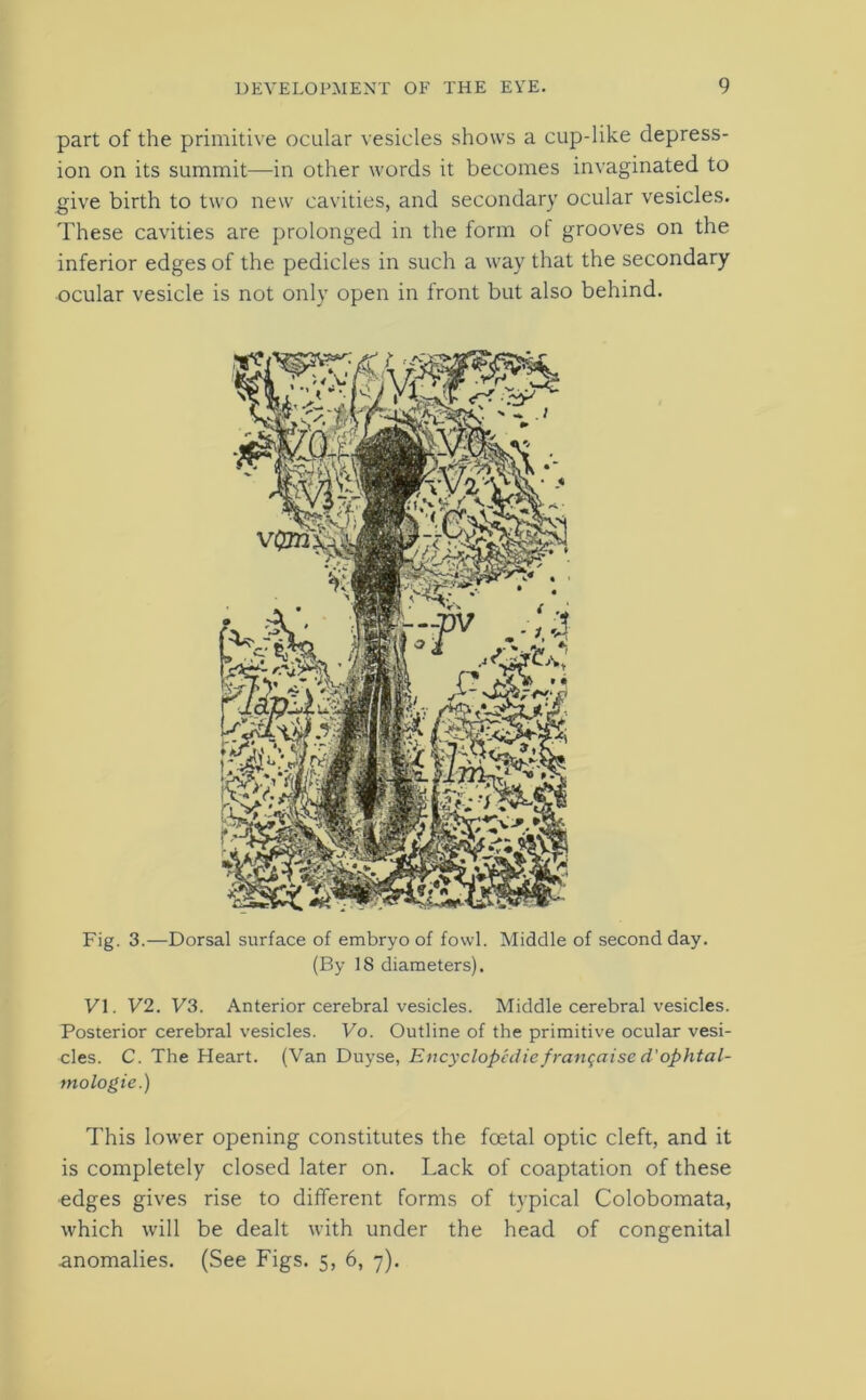 part of the primitive ocular vesicles shows a cup-like depress- ion on its summit—in other words it becomes invaginated to give birth to two new cavities, and secondary ocular vesicles. These cavities are prolonged in the form ot grooves on the inferior edges of the pedicles in such a way that the secondary ocular vesicle is not only open in front but also behind. Fig. 3.—Dorsal surface of embryo of fowl. Middle of second day. (By 18 diameters). VI. V2. V3. Anterior cerebral vesicles. Middle cerebral vesicles. Posterior cerebral vesicles. Vo. Outline of the primitive ocular vesi- cles. C. The Heart. (Van Duyse, Encyclopedic frangaise d'ophtal- mologie.) This lower opening constitutes the foetal optic cleft, and it is completely closed later on. Lack of coaptation of these edges gives rise to different forms of typical Colobomata, which will be dealt with under the head of congenital anomalies. (See Figs. 5, 6, 7).