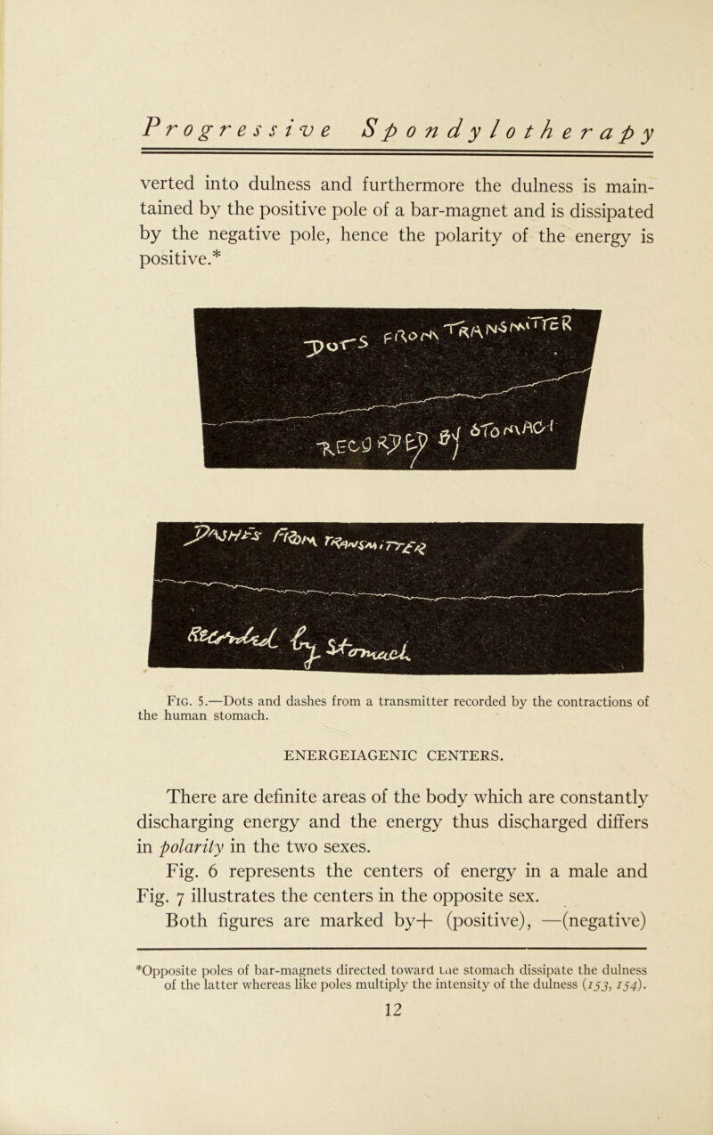 Spondylotherapy Progressive verted into dulness and furthermore the dulness is main- tained by the positive pole of a bar-magnet and is dissipated by the negative pole, hence the polarity of the energy is positive.* Fig. 5.—Dots and dashes from a transmitter recorded by the contractions of the human stomach. ENERGEIAGENIC CENTERS. There are definite areas of the body which are constantly discharging energy and the energy thus discharged differs in polarity in the two sexes. Fig. 6 represents the centers of energy in a male and Fig. 7 illustrates the centers in the opposite sex. Both figures are marked by+ (positive), —(negative) ^Opposite poles of bar-magnets directed toward me stomach dissipate the dulness of the latter whereas like poles multiply the intensity of the dulness (ijj, 154).