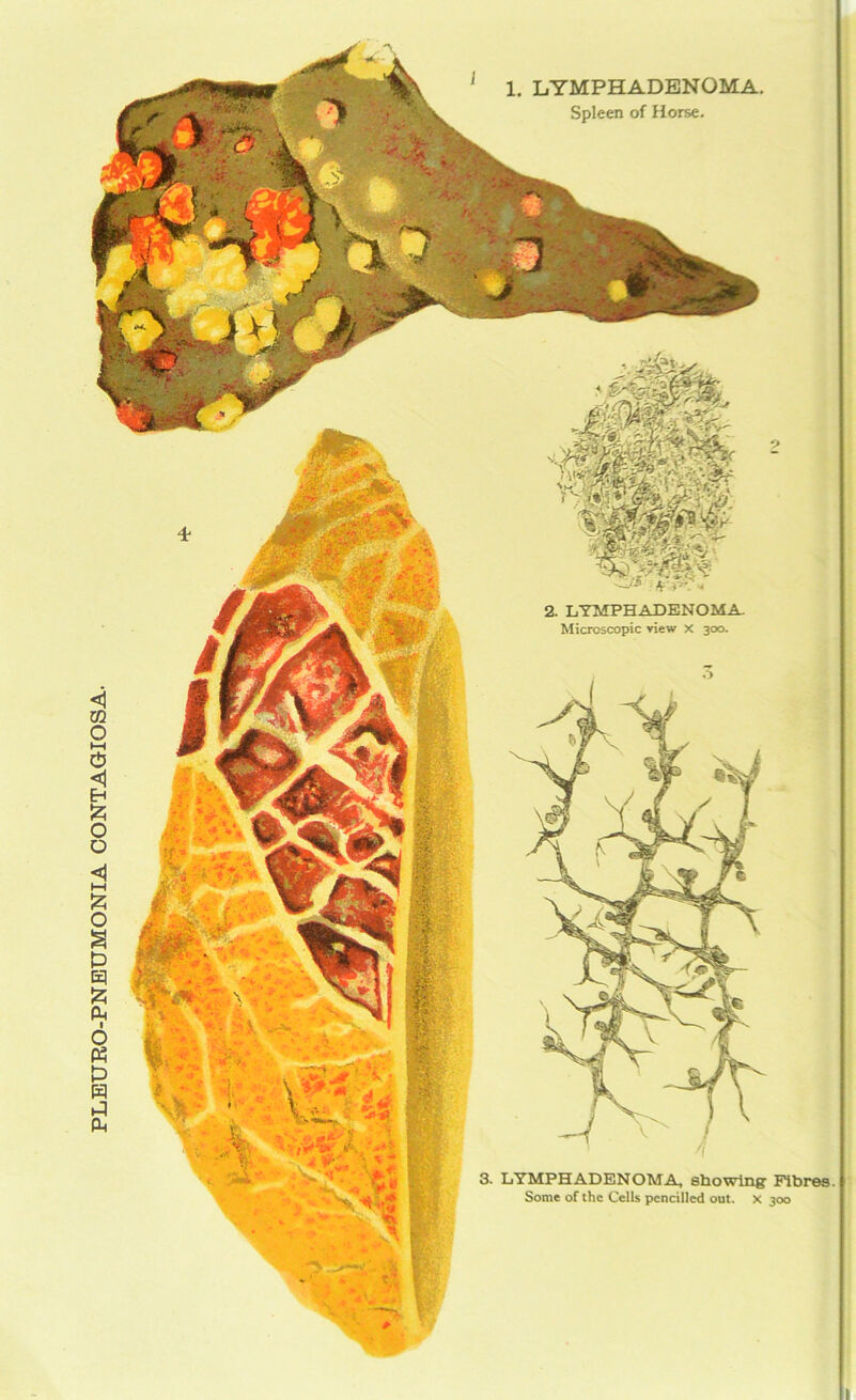 PLEURO-PNEUMONIA CONTAGIOSA. 1. LYMPHADENOMA. Spleen of Horse. 3. LYMPHADENOMA, showing Fibres.! Some of the Cells pencilled out. x 300 2. LYMPHADENOMA Microscopic view X 300.