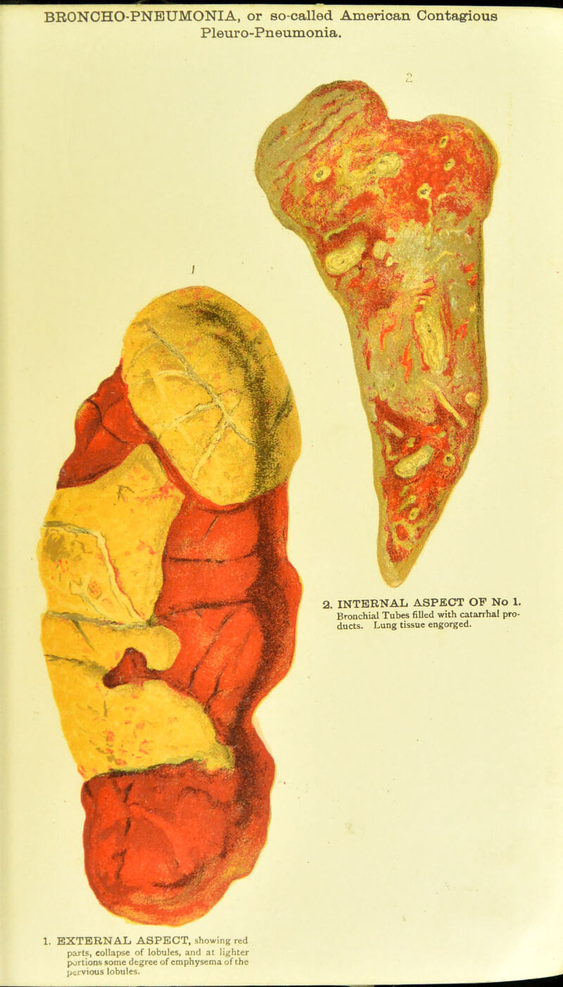 BRONCHO-PNEUMONIA, or so-called American Contagious Pleuro-Pneumonia. 1. EXTERNAL ASPECT, showing red parts, collapse of lobules, and at lighter portions some degree of emphysema of the pervious lobules.