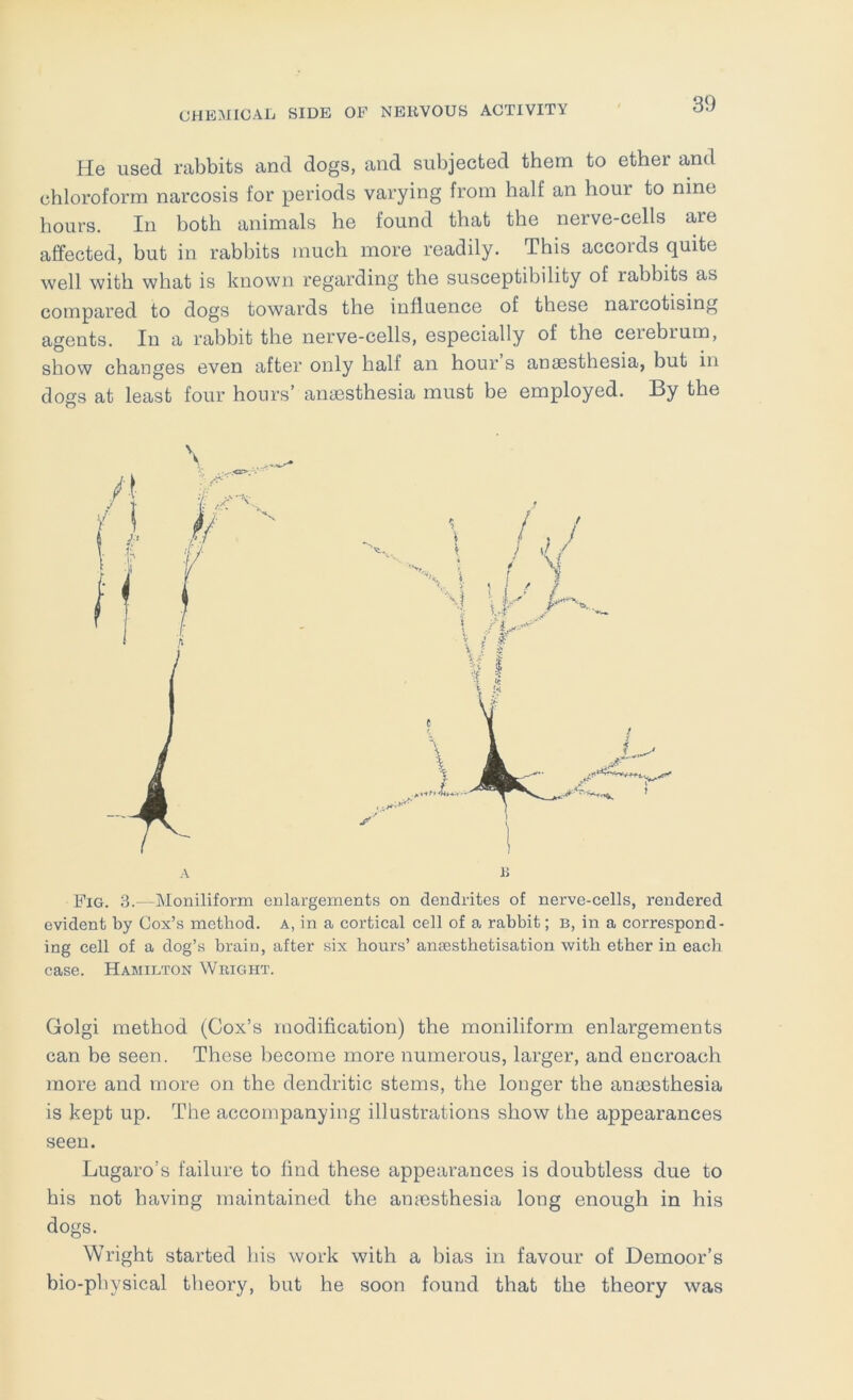 He used rabbits and dogs, and subjected them to ether and chloroform narcosis for periods varying from half an hour to nine hours. In both animals he found that the nerve-cells are affected, but in rabbits much more readily. This accords quite well with what is known regarding the susceptibility of rabbits as compared to dogs towards the influence of these narcotising agents. In a rabbit the nerve-cells, especially of the cerebrum, show changes even after only half an hour s anaesthesia, but in dogs at least four hours’ anaesthesia must be employed. By the Fig. 3.—Moniliform enlargements on dendrites of nerve-cells, rendered evident by Cox’s method, a, in a cortical cell of a rabbit; b, in a correspond- ing cell of a dog’s brain, after six hours’ amesthetisation with ether in each case. Hamilton Wright. Golgi method (Cox’s modification) the moniliform enlargements can be seen. These become more numerous, larger, and encroach more and more on the dendritic stems, the longer the anaesthesia is kept up. The accompanying illustrations show the appearances seen. Lugaro’s failure to find these appearances is doubtless due to his not having maintained the anmsthesia long enough in his dogs. Wright started his work with a bias in favour of Demoor’s bio-physical theory, but he soon found that the theory was \ A