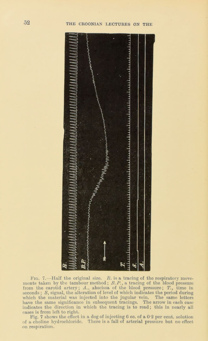 Fig. 7.—Half the original size. R. is a tracing of the respiratory move- ments taken by the tambour method; B. P., a tracing of the blood pressure from the carotid artery; A.^ abscissa of the blood pressure; T., time in seconds ; S, signal, the alteration of level of which indicates the period during which the material was injected into the jugular vein. The same letters have the same significance in subsequent tracings. The arrow in each case indicates the direction in which the tracing is to read; this in nearly all cases is from left to right. Fig. 7 shows the effect in a dog of injecting G cc. of a 0'2 per cent, solution of a choline hydrochloride. There is a faU of arterial pressure but no effect on respiration.