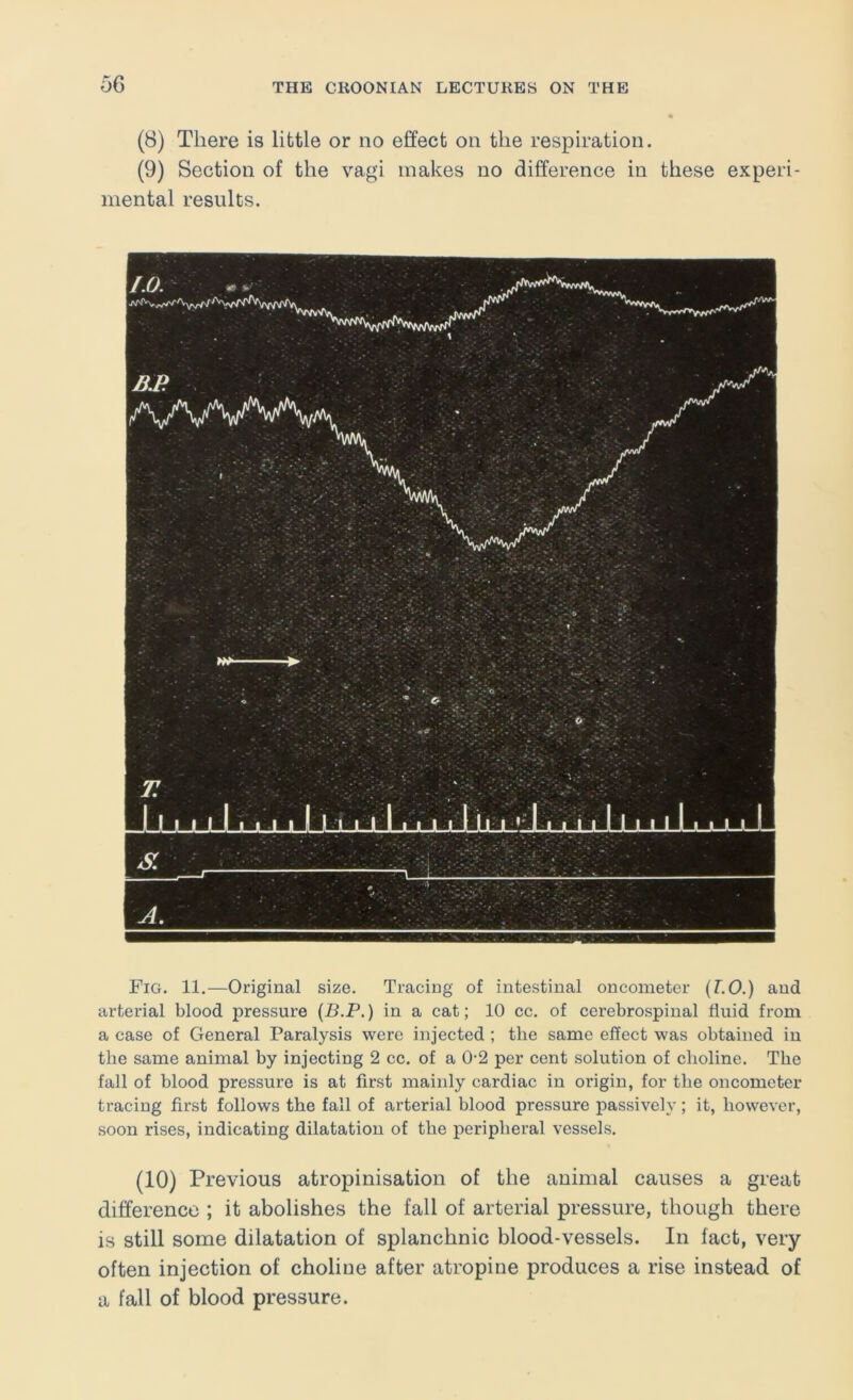 (8) There is little or no effect on the respiration. (9) Section of the vagi makes no difference in these experi- mental results. Fig. 11.—Original size. Tracing of intestinal oncometer (T.O.) and arterial blood pressure {B.P.) in a cat; 10 cc. of cerebrospinal fluid from a case of General Paralysis were injected ; the same effect was obtained in the same animal by injecting 2 cc. of a 0-2 per cent solution of choline. The fall of blood pressure is at first mainly cardiac in origin, for the oncometer tracing first follows the fall of arterial blood pressure passively; it, however, soon rises, indicating dilatation of the peripheral vessels. (10) Previous atropinisation of the animal causes a great difference ; it abolishes the fall of arterial pressure, though there is still some dilatation of splanchnic blood-vessels. In fact, very often injection of choline after atropine produces a rise instead of a fall of blood pressure.