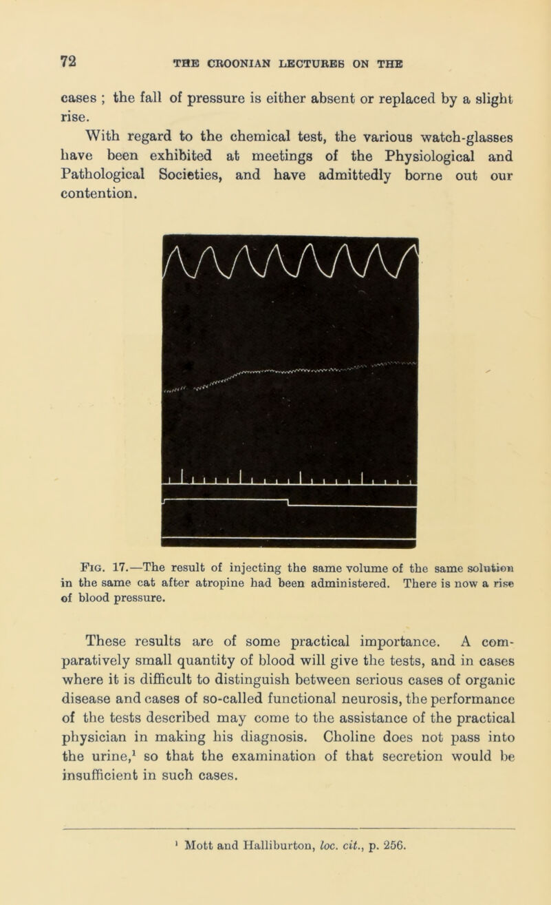 cases ; the fall of pressure is either absent or replaced by a slight rise. With regard to the chemical test, the various watch-glasses have been exhibited at meetings of the Physiological and Pathological Societies, and have admittedly borne out our contention. Fig. 17.—The result of injecting the same volume of the same solution in the same cat after atropine had been administered. There is now a rise of blood pressure. These results are of some practical importance. A com- paratively small quantity of blood will give the tests, and in cases where it is difiBcult to distinguish between serious cases of organic disease and cases of so-called functional neurosis, the performance of the tests described may come to the assistance of the practical physician in making his diagnosis. Choline does not pass into the urine,^ so that the examination of that secretion would be insufficient in such cases. ' Mott and Halliburton, loc. cit., p. 256.