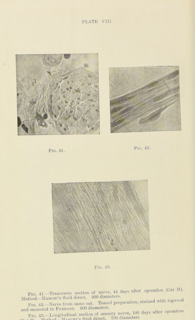 Fig. 43. Pio. 41,-Transverse section of nerve, 44 days after operation (Cat H). Method—Marchi’s fluid direct. 200 diameters. ^ -.i i Fig. 42.—Nerve from same cat. Teased preparation, stamed with og%\ nnd mounted in Farrant. 500 diameters. Fig 43 -Longitudinal section of sensory nerve, lOG days after opera ion j: ivj. , o nrii'-- Tnn flin.i-np.tftrs