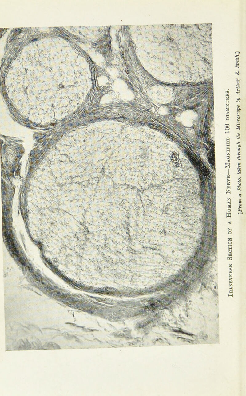 TRANSVERSE SECTION OF A HOMAN NERVE—MAGNIFIED 100 DIAMETERS. [From a Photo, taken through the Microscope by Arthur E. Smith.']