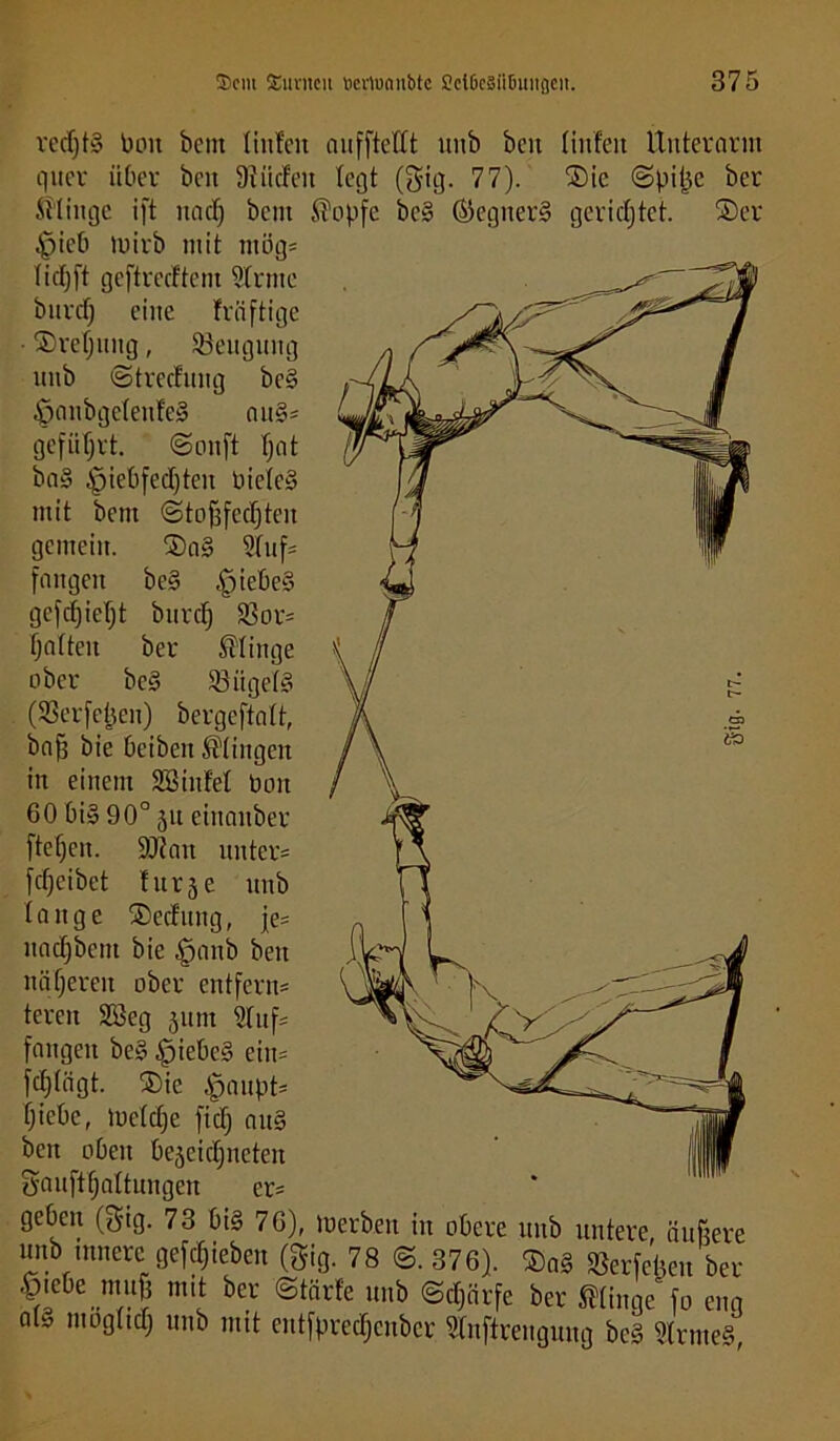 redjtg Poit bcnt tiufcii aufftctlt imö beit (inf'eit Unteramt quer über beit 9iiicfeit tegt (gig. 77). ®ie ©pitje ber klinge ift itad) bcnt ®opfe bc§ ©egner§ gerichtet. ®er £>icb toirb mit mög* Ticf)ft geftrecftent Sinne bitrcfj eilte fräftige • ®refjuitg, ^Beugung ttiib ©trecfuug be§ £janbgclenfe§ a«§= geführt, ©onft tjat ba§ $iebfed)teit bicteS mit betit ©tofffecfjteit gemein. 2)a§ 3fuf= fangen be§ |>iebe§ gefdfjietjt burdj SSor= fjatteu ber klinge ober bc§ 93iiget§ (S3erfejjeit) bergeftalt, baff bie beiben Gingen in einem 2B infei Don 60 bi§ 90° 51t einattber ftetjcit. SRatt unter* fdjeibet !ur§e uitb I a lt g e ®ecfuitg, je* Halbem bie $aub beit näheren ober entfern* tereit 2öeg junt Stuf* fangen be§ £)iebc§ ein* fctjtägt. ®ic Apaupt* fjicbc, luetcfje fiel) auS beit oben bejeidjiteteit gaufttjattungen er* geben (gig. 73 bi§ 76), »erben in obere uttb untere, äußere unb untere gerieben (gig. 78 ©. 376). ®a§ Sßerfetjeu ber &ebe„m«t mit ber ©tärfe unb ©cl}ürfe ber Jffinge fo eng a(» mogticfj unb mit eittfprecfjcubcr Slitftrengung be§ Strme§,