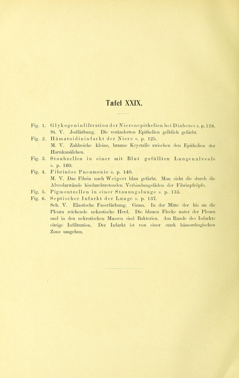 Fig. 1. Glykoge n i nf iltration der Nierenepi thelien bei D iabetes s. p. 128. St. V. Jodfärbung. Die veränderten Epitkelien gelblich gefärbt. Fig. 2. Hämatoidininfarkt der Niere s. p. 125. M. V. Zahlreiche kleine, braune Krystalle zwischen den Epithelien der Harnkanälchen. Fig. 3. Staubzellen in einer mit Blut gefüllten Lu n gen a 1 ve o le s. p. 160. Fig. 4. Fibrinöse Pneumonie s. p. 140. M. V. Das Fibrin nach Weigert blau gefärbt. Man sieht die durch die Alveolarwände hindurch tretenden Verbindungsfäden der Fibrinpfröpfe. Fig. 5. Pigmentzellen in einer Stauungslunge s. p. 133. Fig. 6. Septischer Infarkt der Lunge s. p. 137. Sch. V. Elastische Faserfärbung. Gram. In der Mitte der bis an die Pleura reichende nekrotische Heid. Die blauen Flecke unter der Pleura und in den nekrotischen Massen sind Bakterien. Am Rande des Infarkts eitrige Infiltration. Der Infarkt ist von einer stark hämorrhagischen Zone umgeben.