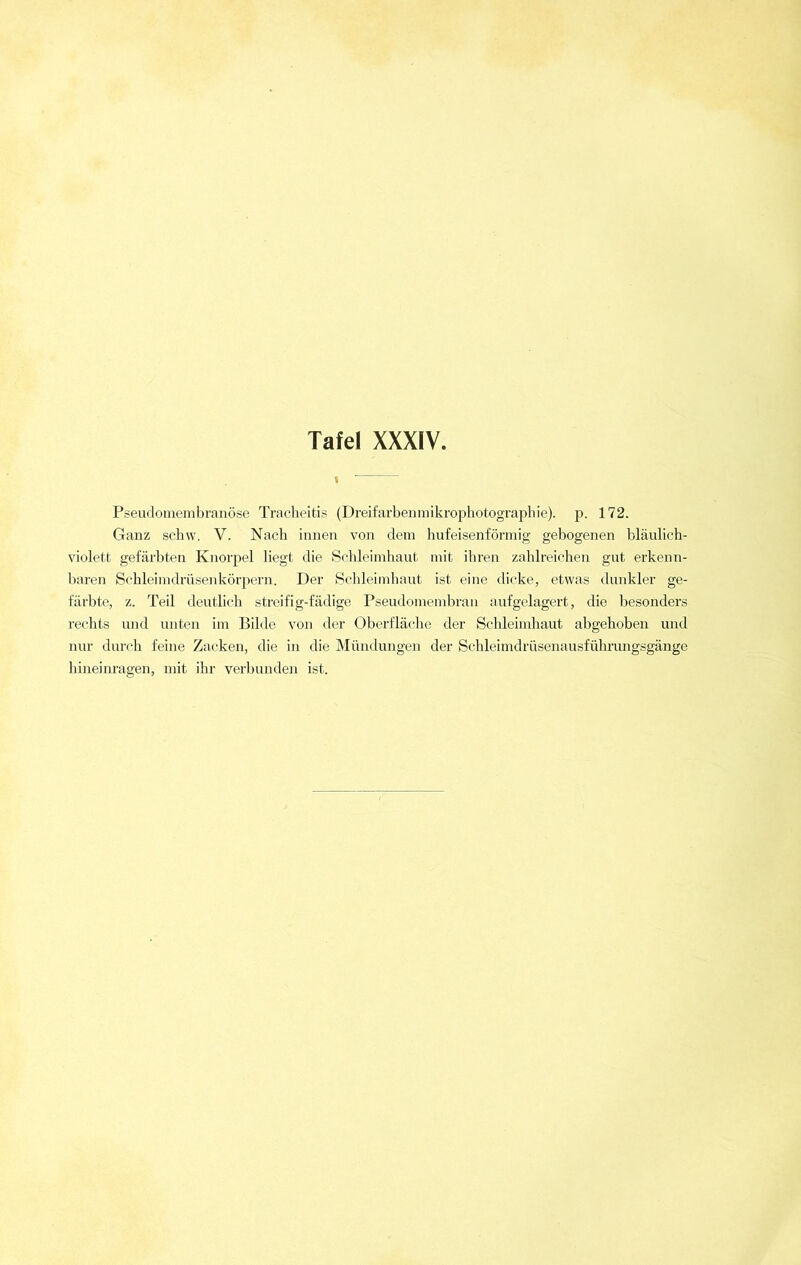 i Pseudomembranöse Tracheitis (Dreifarbenmikrophotographie), p. 172. Ganz schw. V. Nach innen von dem hufeisenförmig gebogenen bläulich- violett. gefärbten Knorpel liegt die Schleimhaut mit ihren zahlreichen gut erkenn- baren Schleimdrüsenkörpern. Der Schleimhaut ist eine dicke, etwas dunkler ge- färbte, z. Teil deutlich streifig-fädige Pseudomembran aufgelagert, die besonders rechts und unten im Bilde von der Oberfläche der Schleimhaut abgehoben und nur durch feine Zacken, die in die Mündungen der Schleimdrüsenausführungsgänge hineinragen, mit ihr verbunden ist.